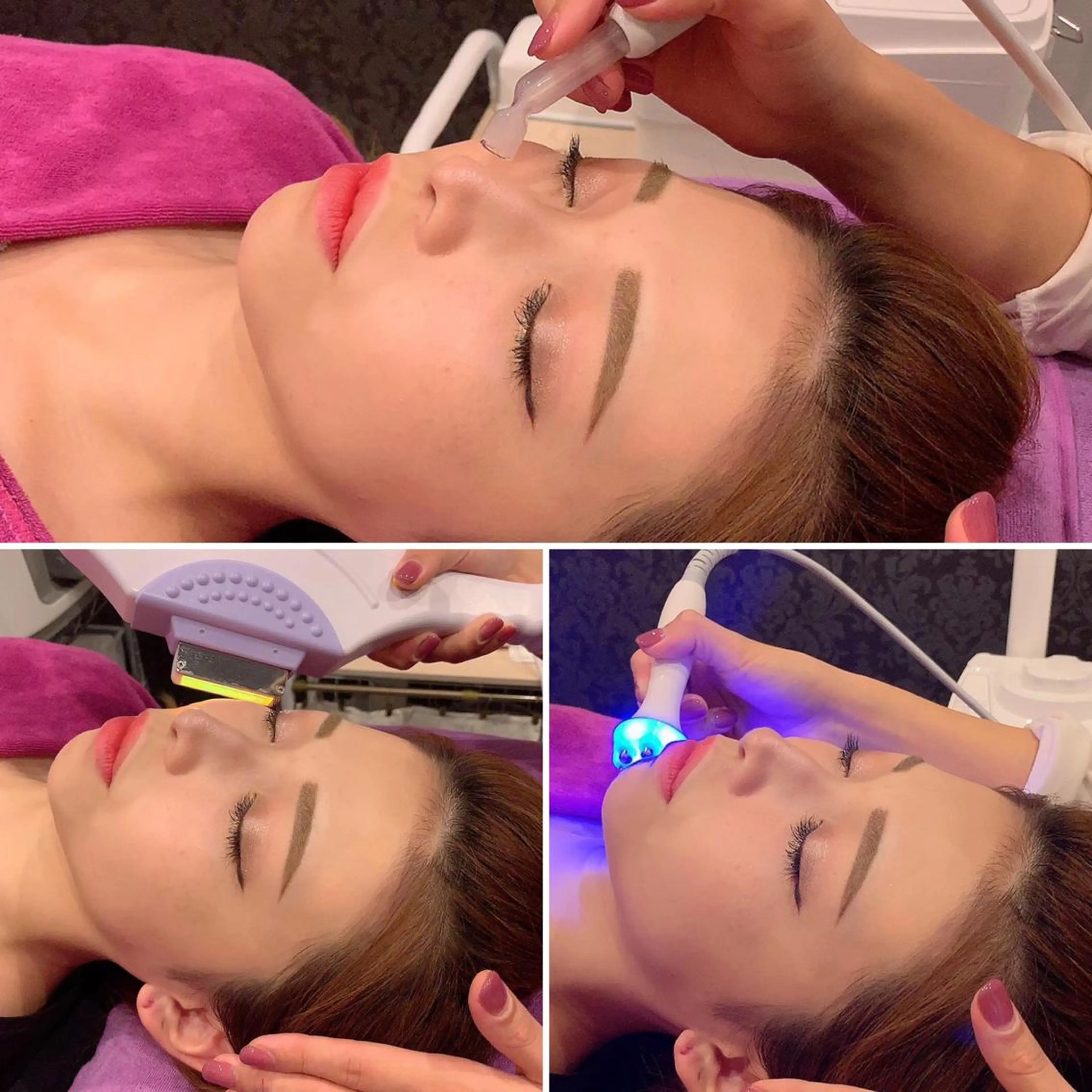 男女ok【エイジングケアコース約60分】毛穴洗浄×光フォト×ポレーション美容液導入の写真