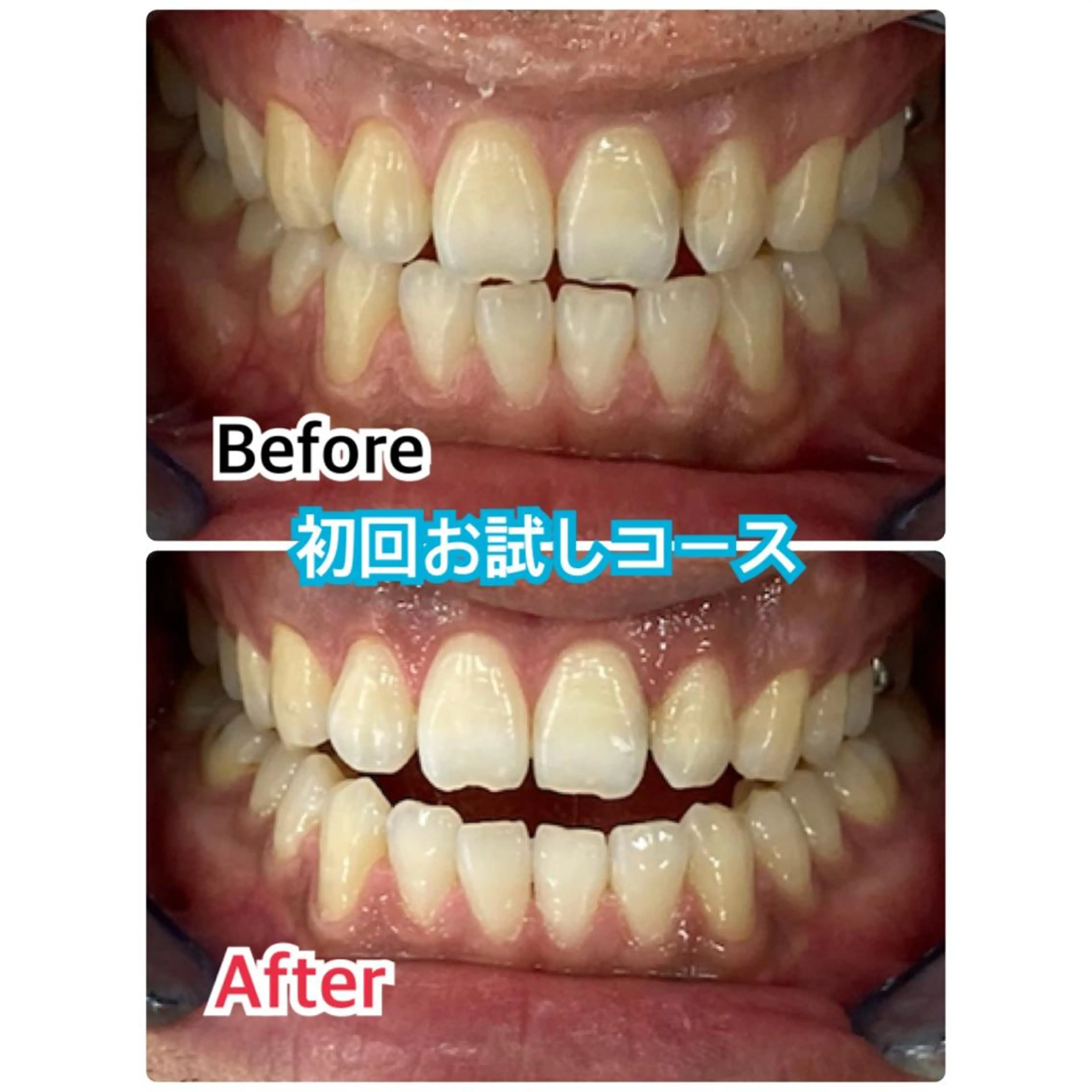 プラチナムビューティー柏所属・【歯科連携】柏ホワイ トニング専門店のその他イメージ