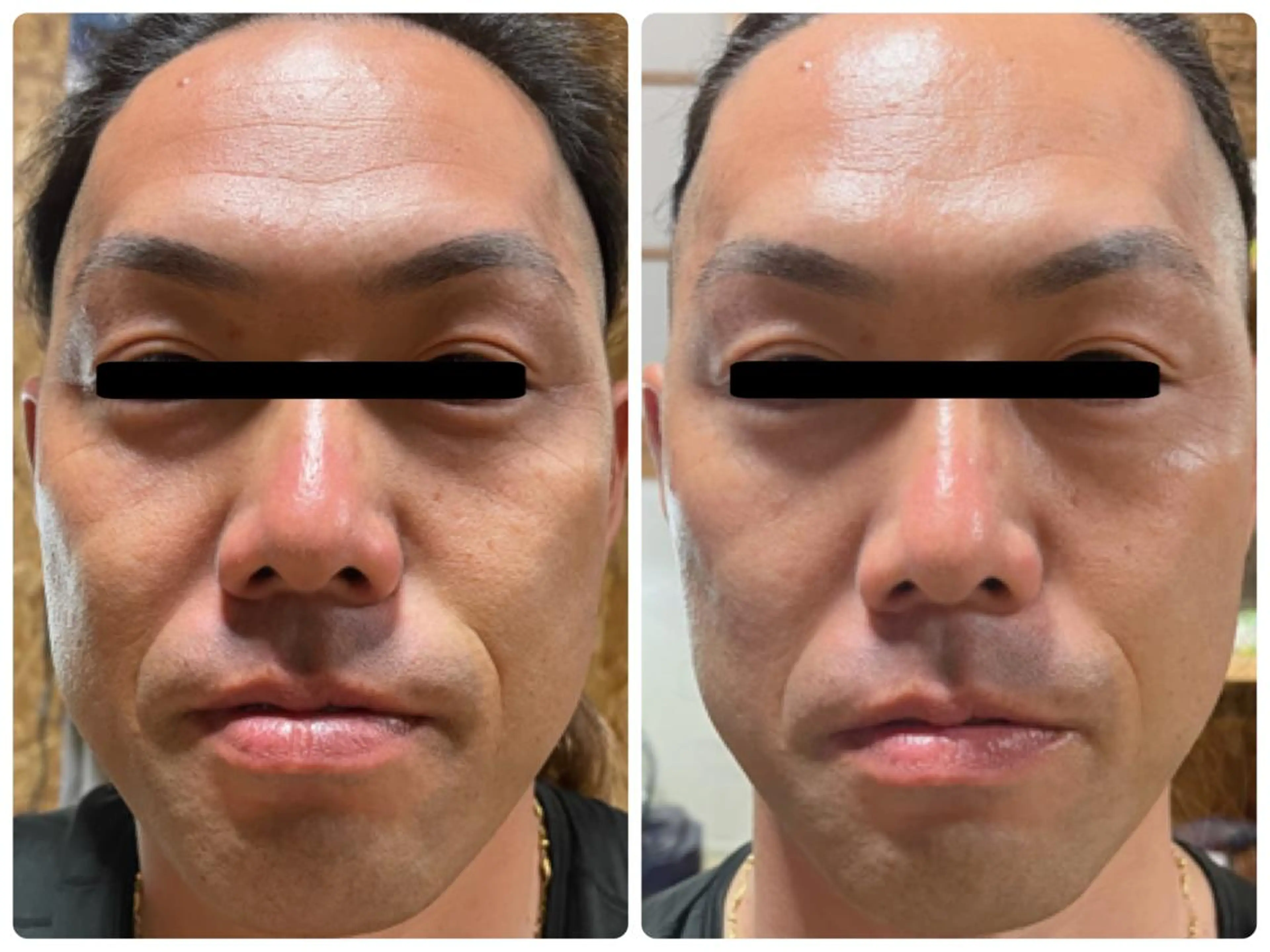 Eyelash Salon 4Uのマツエク・マツパデザイン