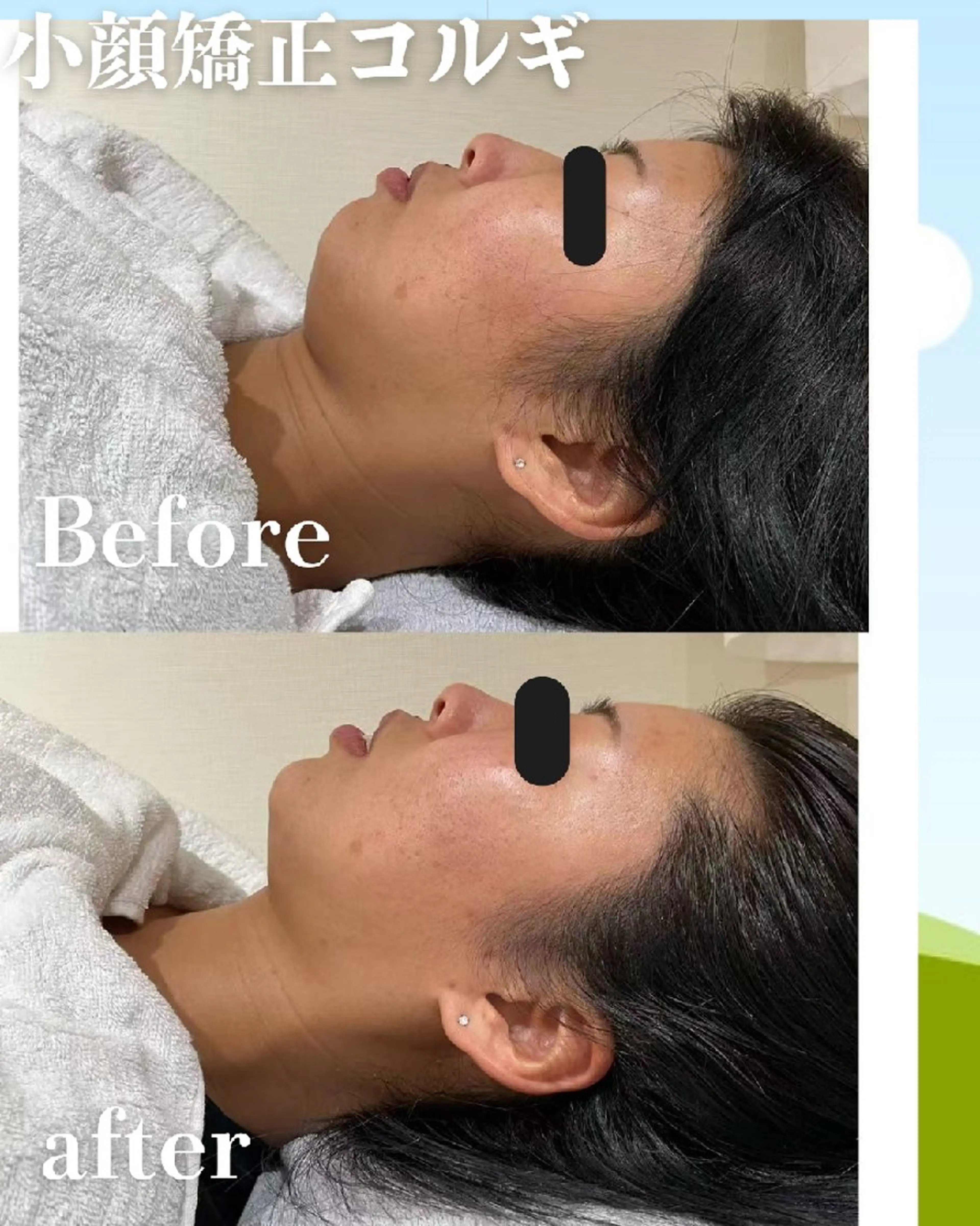 エステ リラク 高岳/久屋大通　脱毛 コルギ🌿ENSHIのエステ・リラクイメージ