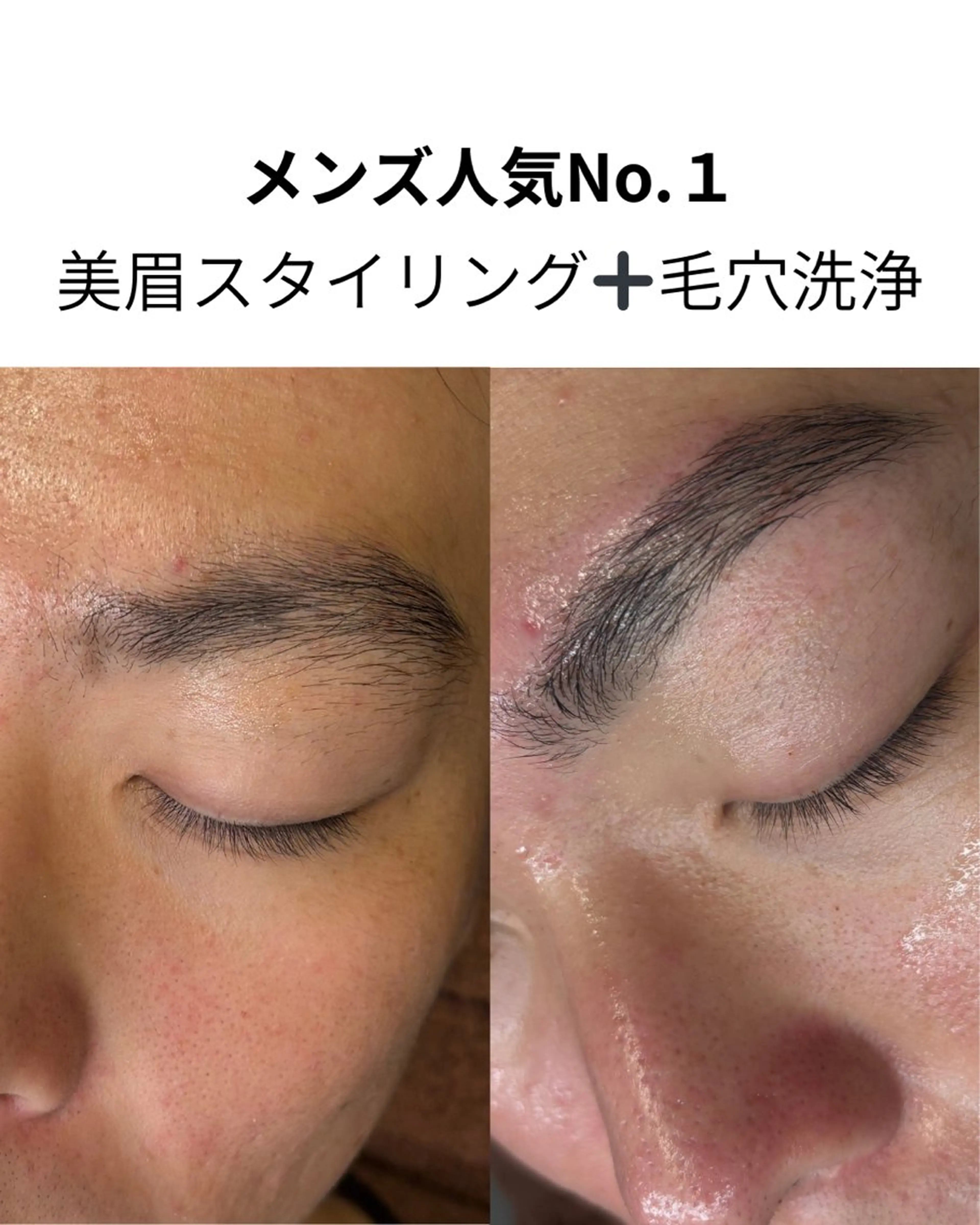 メンズ人気No.1 美眉スタイリング＋毛穴洗浄の写真