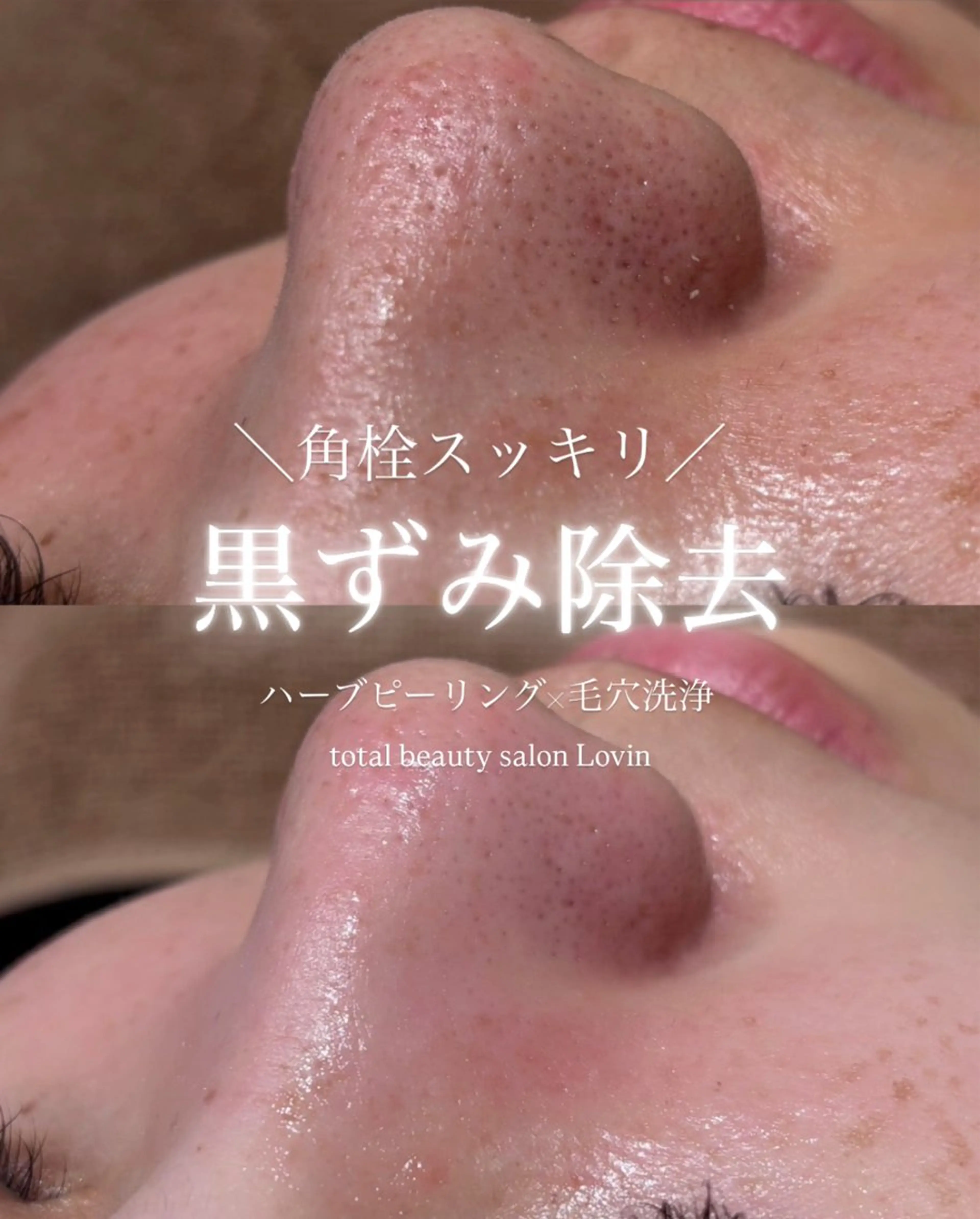 lovin manaのエステ・リラクイメージ