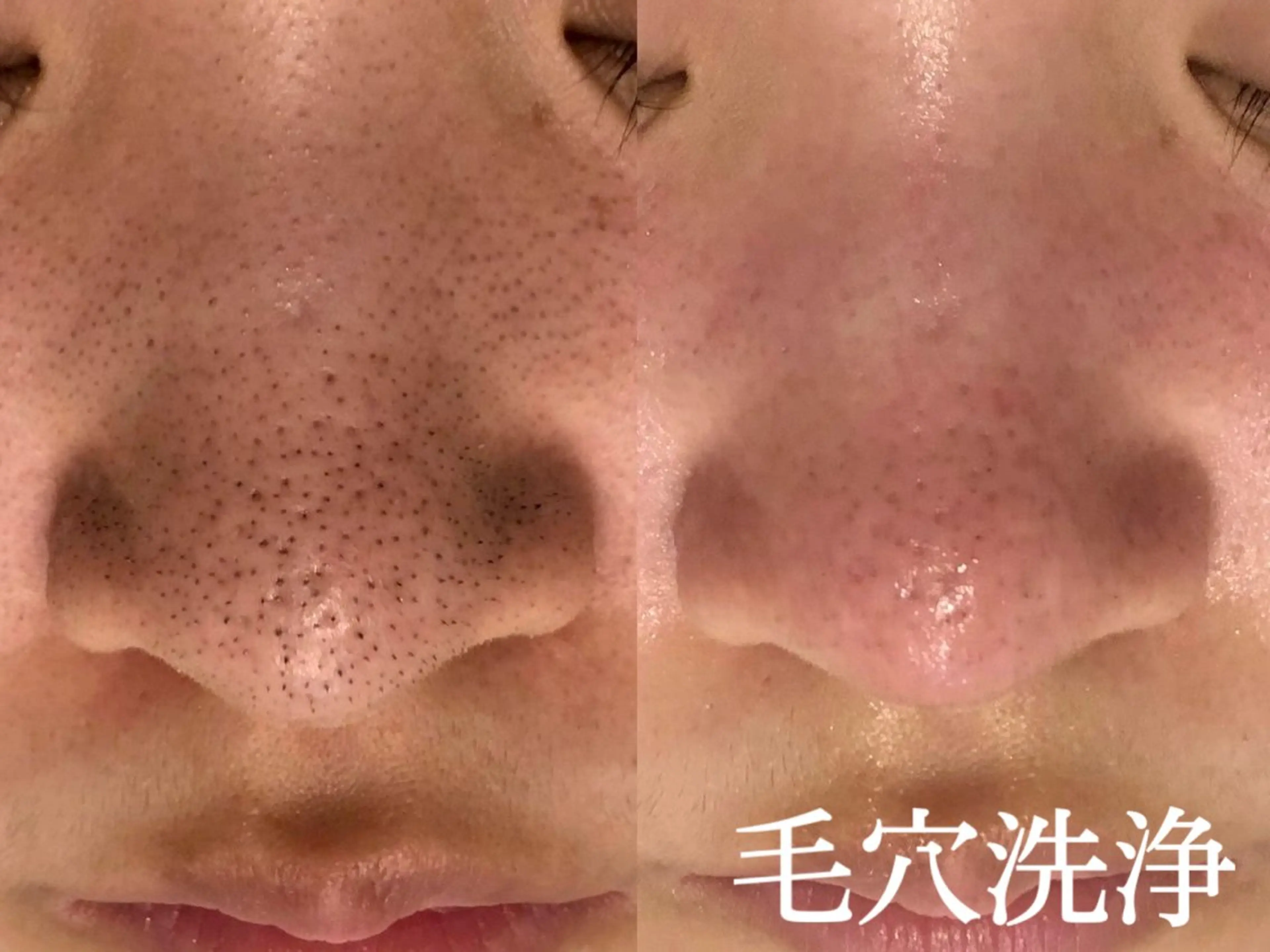 エステ 🌼SALON Lazuli久留米のエステ・リラクイメージ