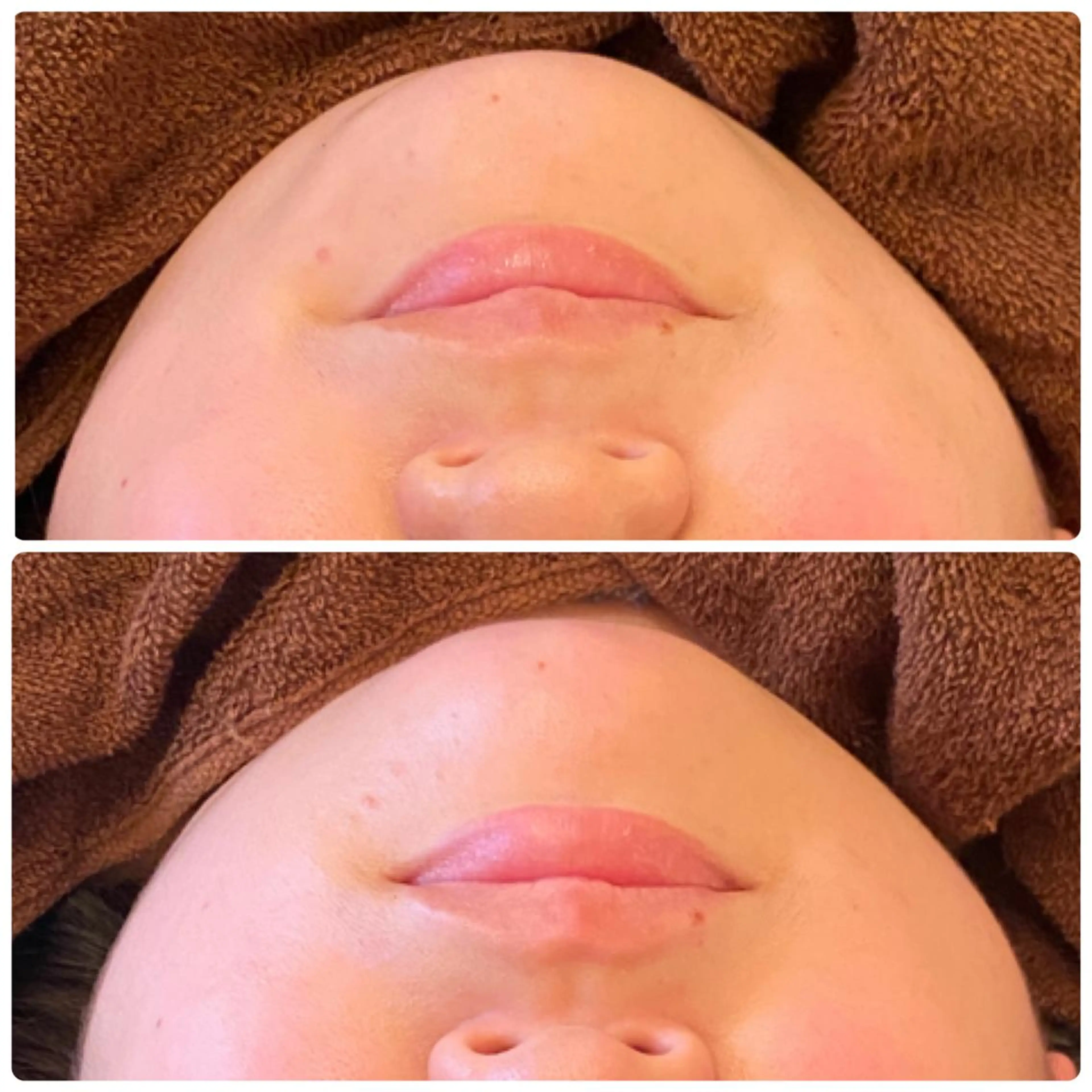 FLEUR大阪・整体 ・ハイフ・痩身・小顔のエステ・リラクイメージ