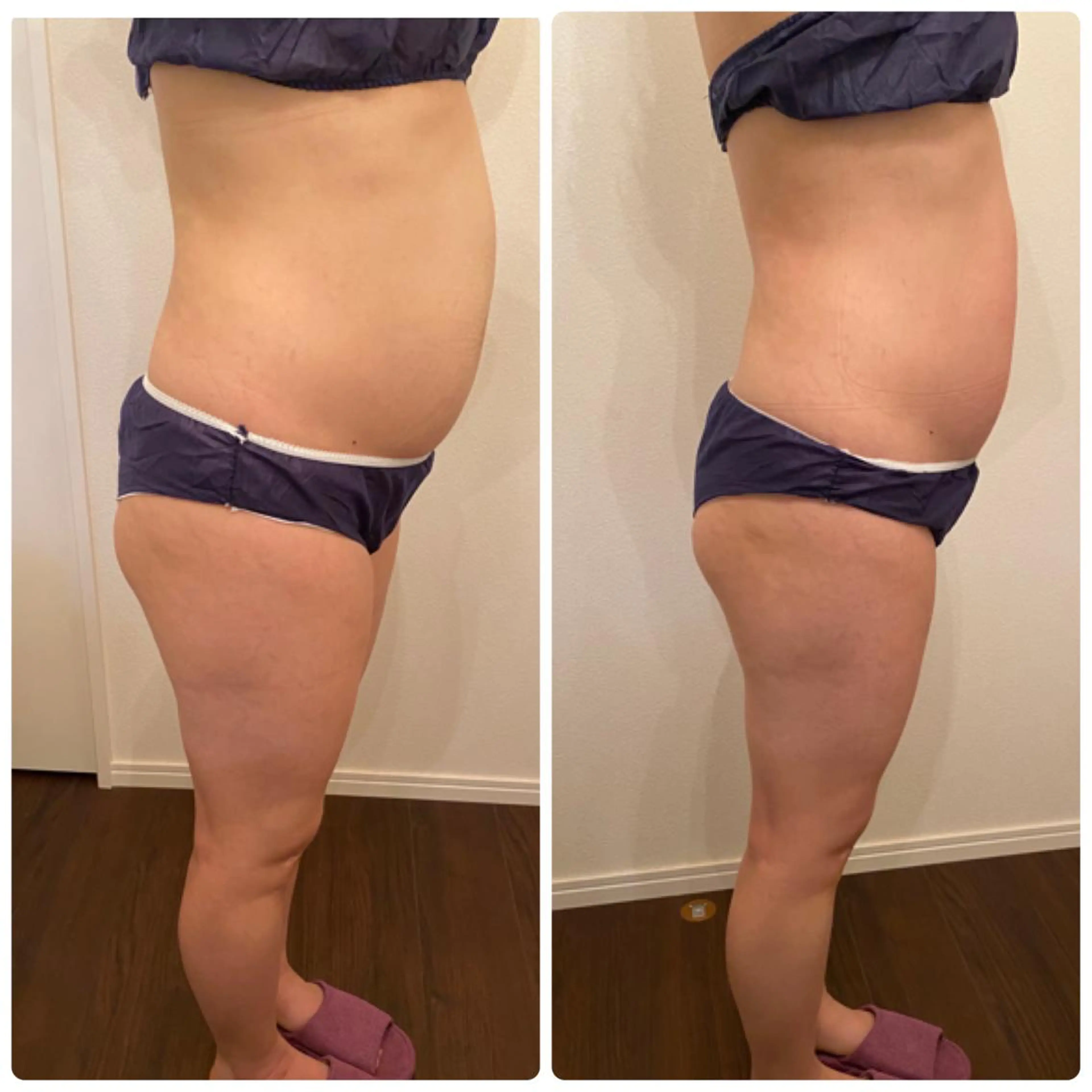 FLEUR大阪・整体 ・ハイフ・痩身・小顔のエステ・リラクイメージ