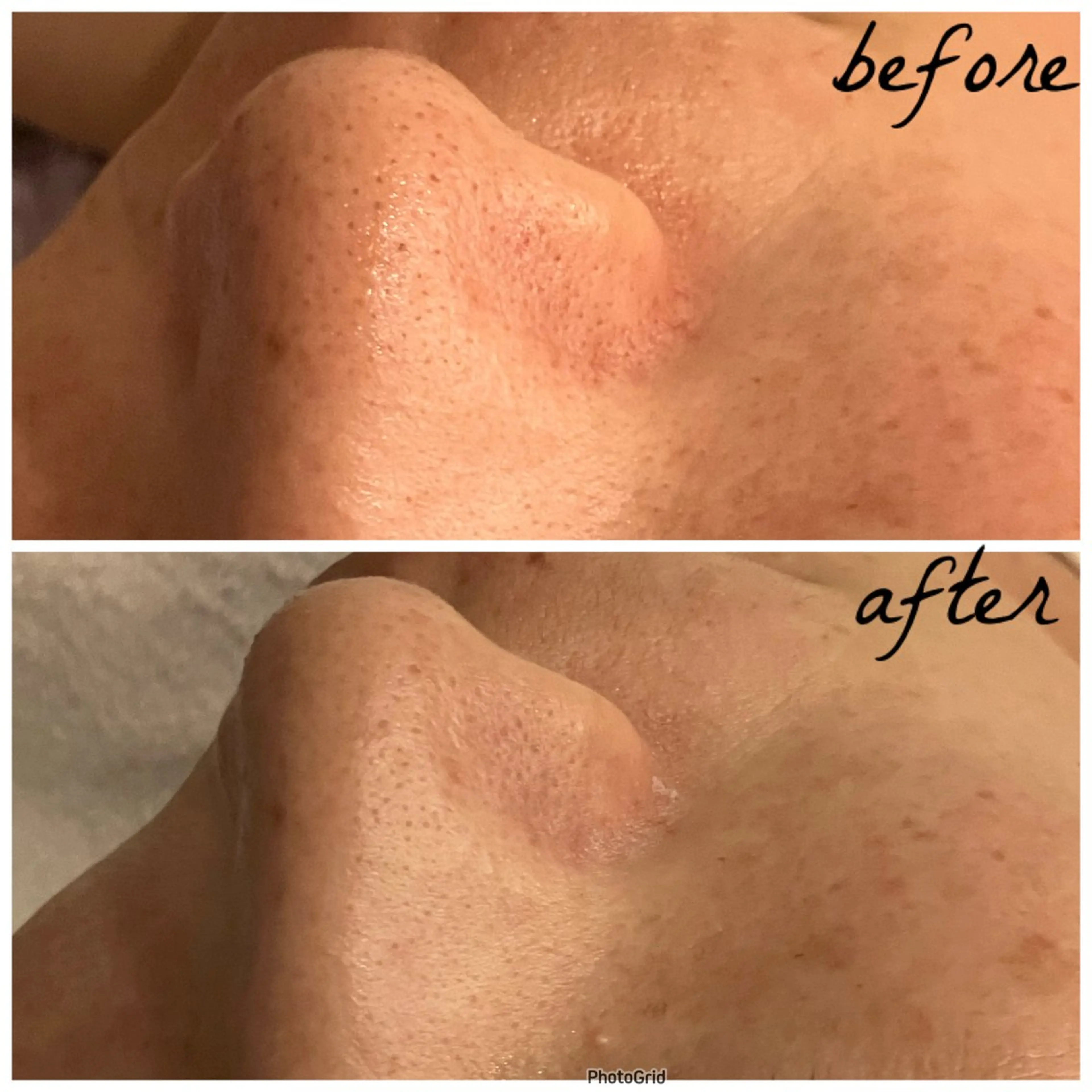 メンズ メナード岐阜茜部 杉浦のエステ・リラクイメージ