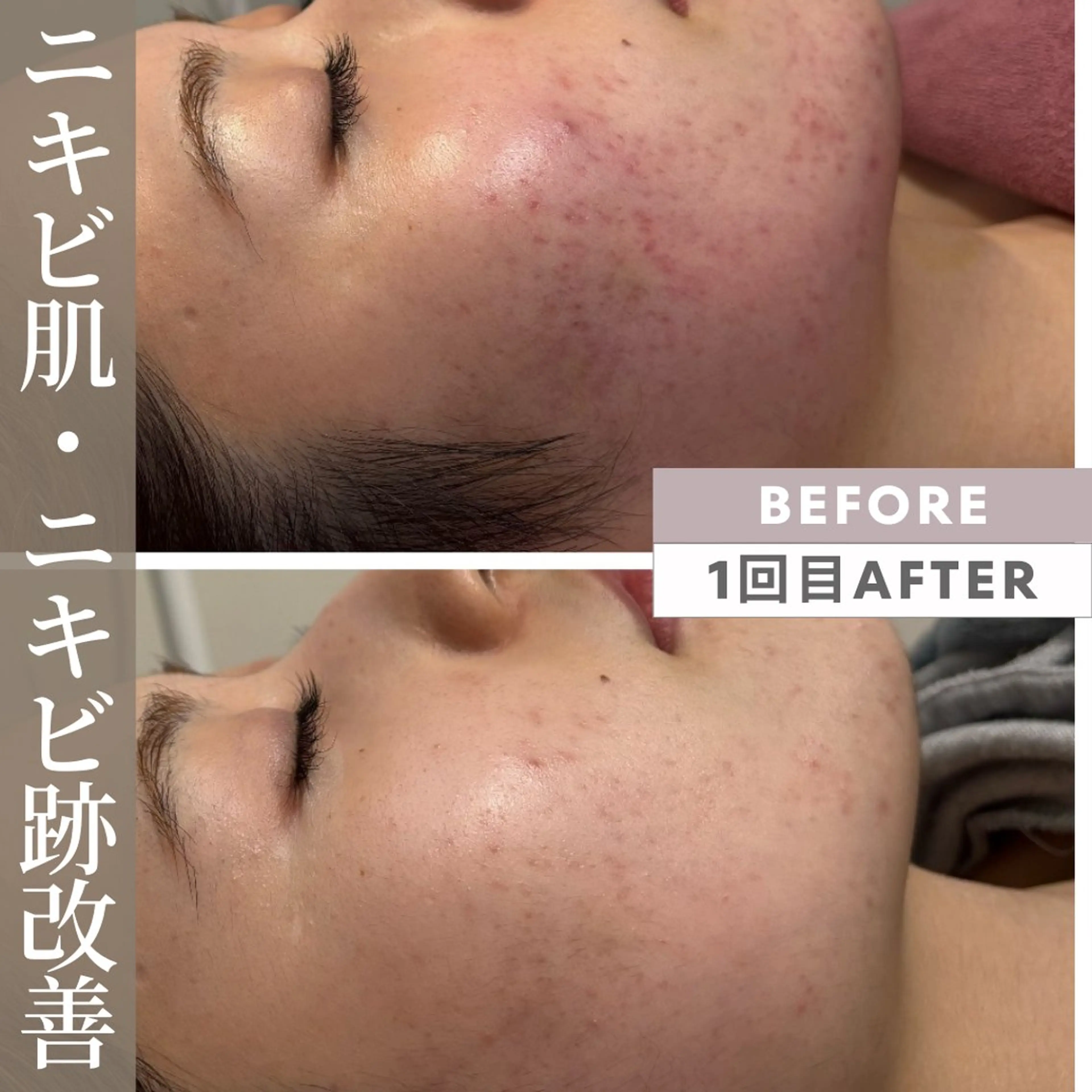 エステ 小顔矯正専門店 【RED】池田のエステ・リラクイメージ