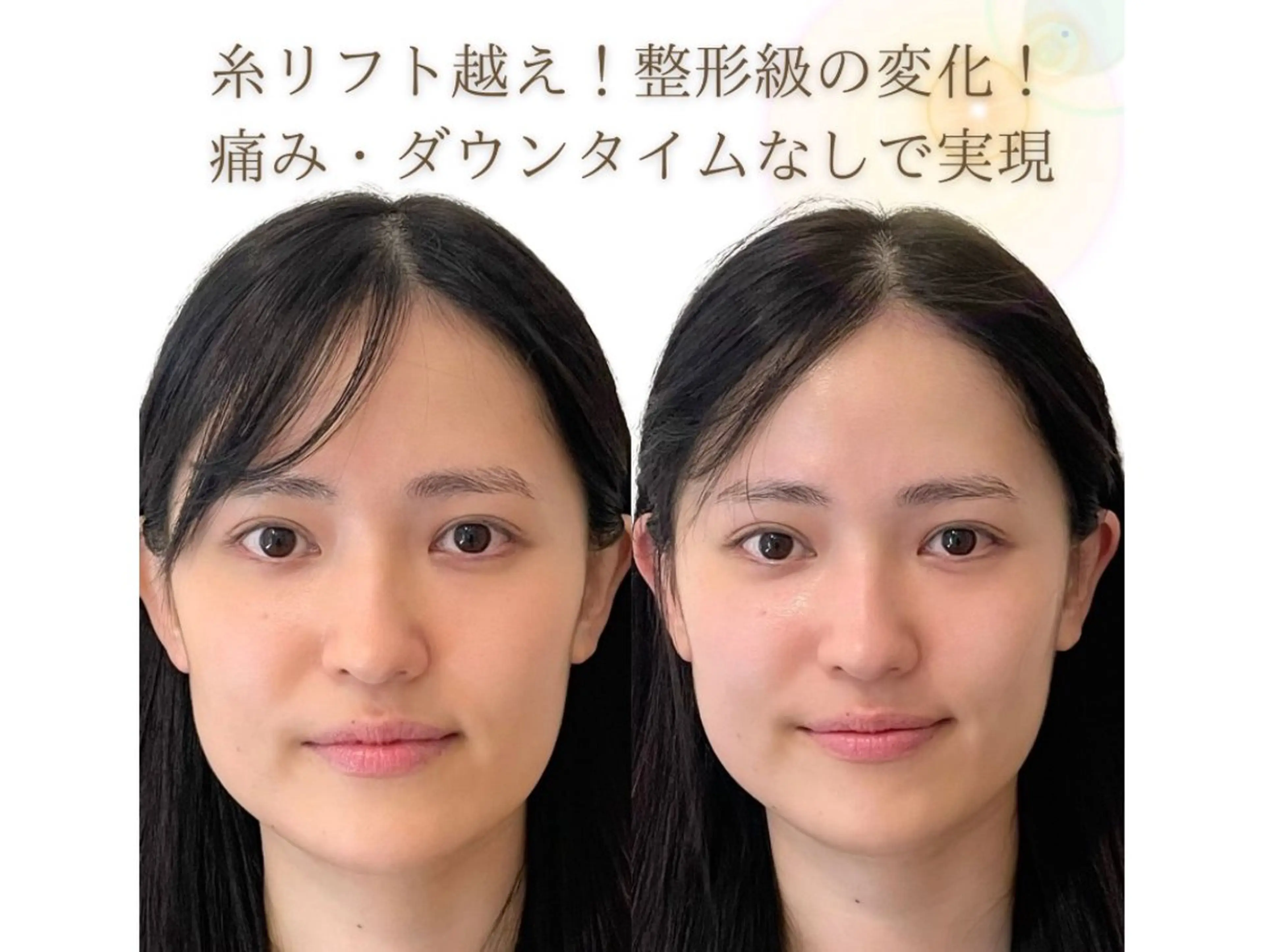 エステ 小顔/たるみ/黒ずみ除去専門サロン/SONA 大和西大寺店所属・【小顔専門看護師 サロンSONA】のエステ・リラクイメージ