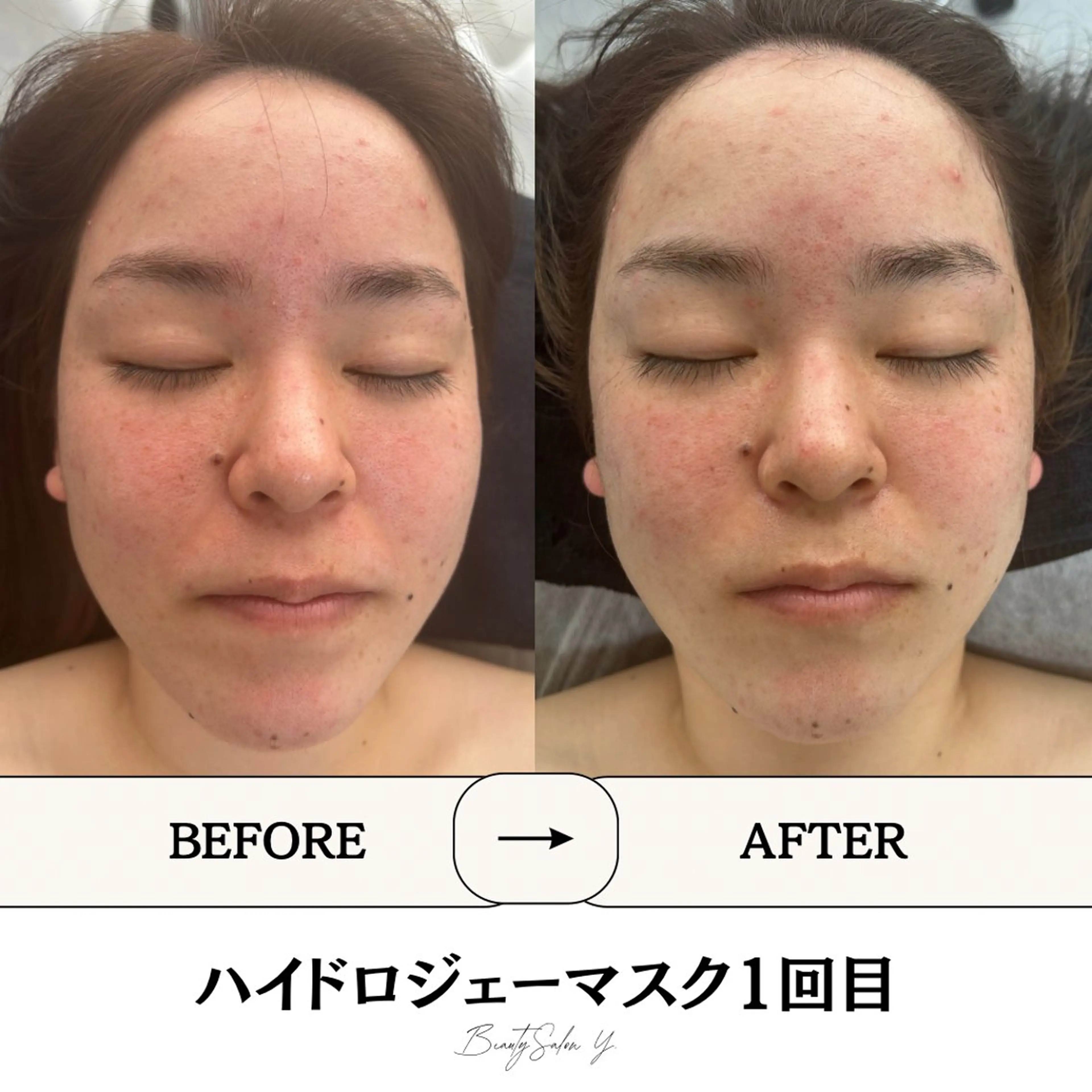 ダイエット専門店 Y.【ワイドット】のエステ・リラクイメージ
