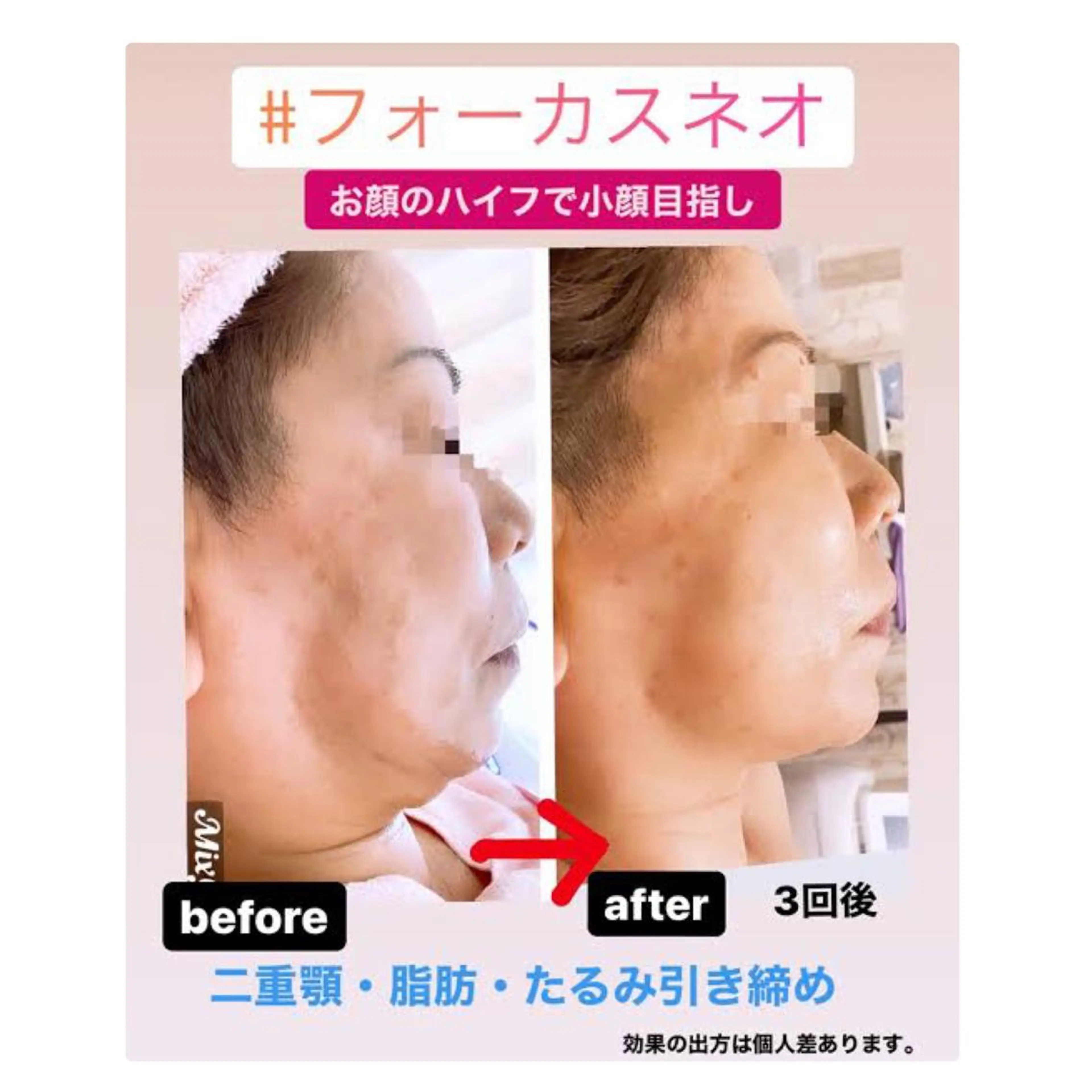 美肌/小顔/眉毛の 専門店 ルミナスのエステ・リラクイメージ