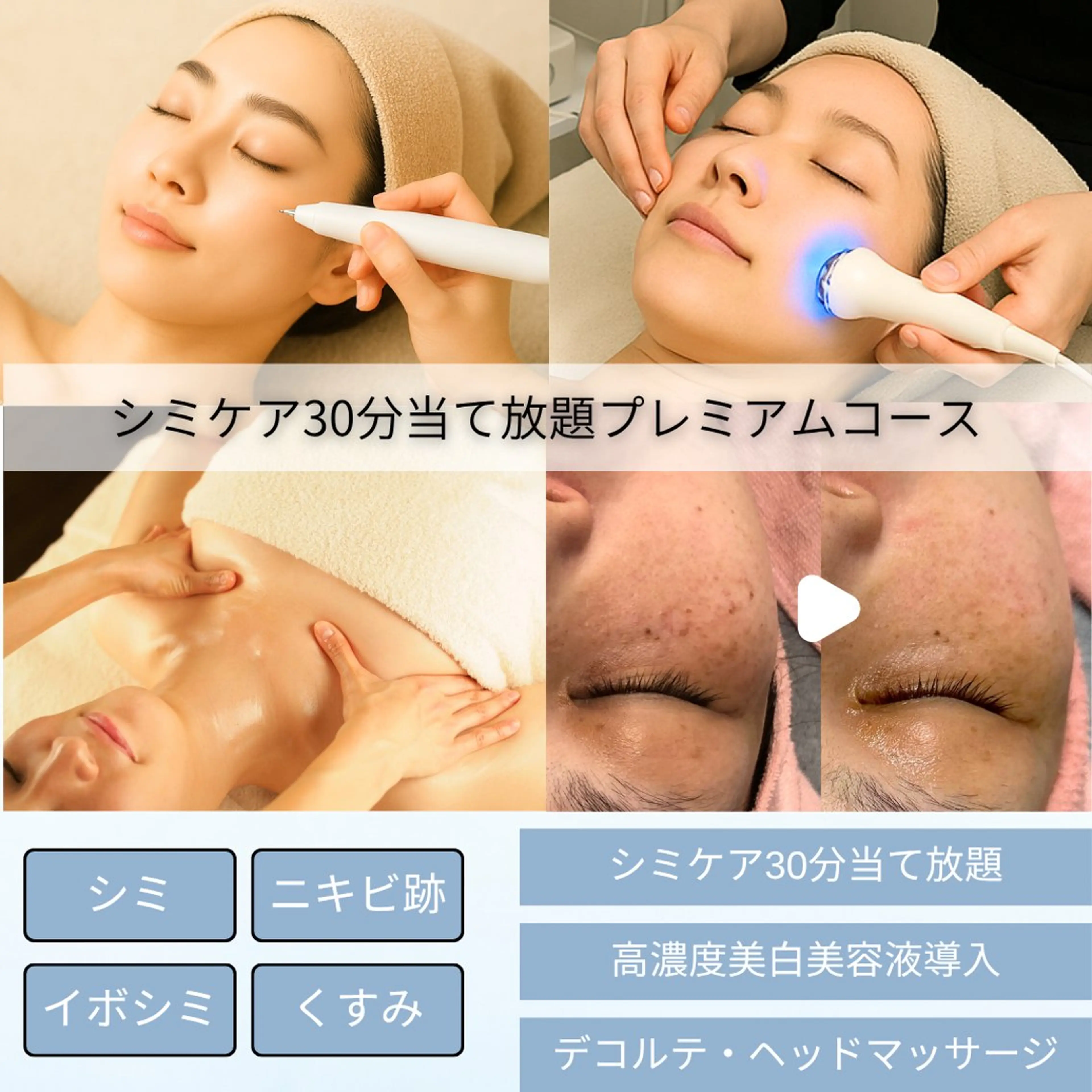 【本日・破格につき1名様限定❗️】シミ取り30分当て放題×美白美容液導入×ヘッド・デコルテ【1週間でシミがポロっと剥離】の写真