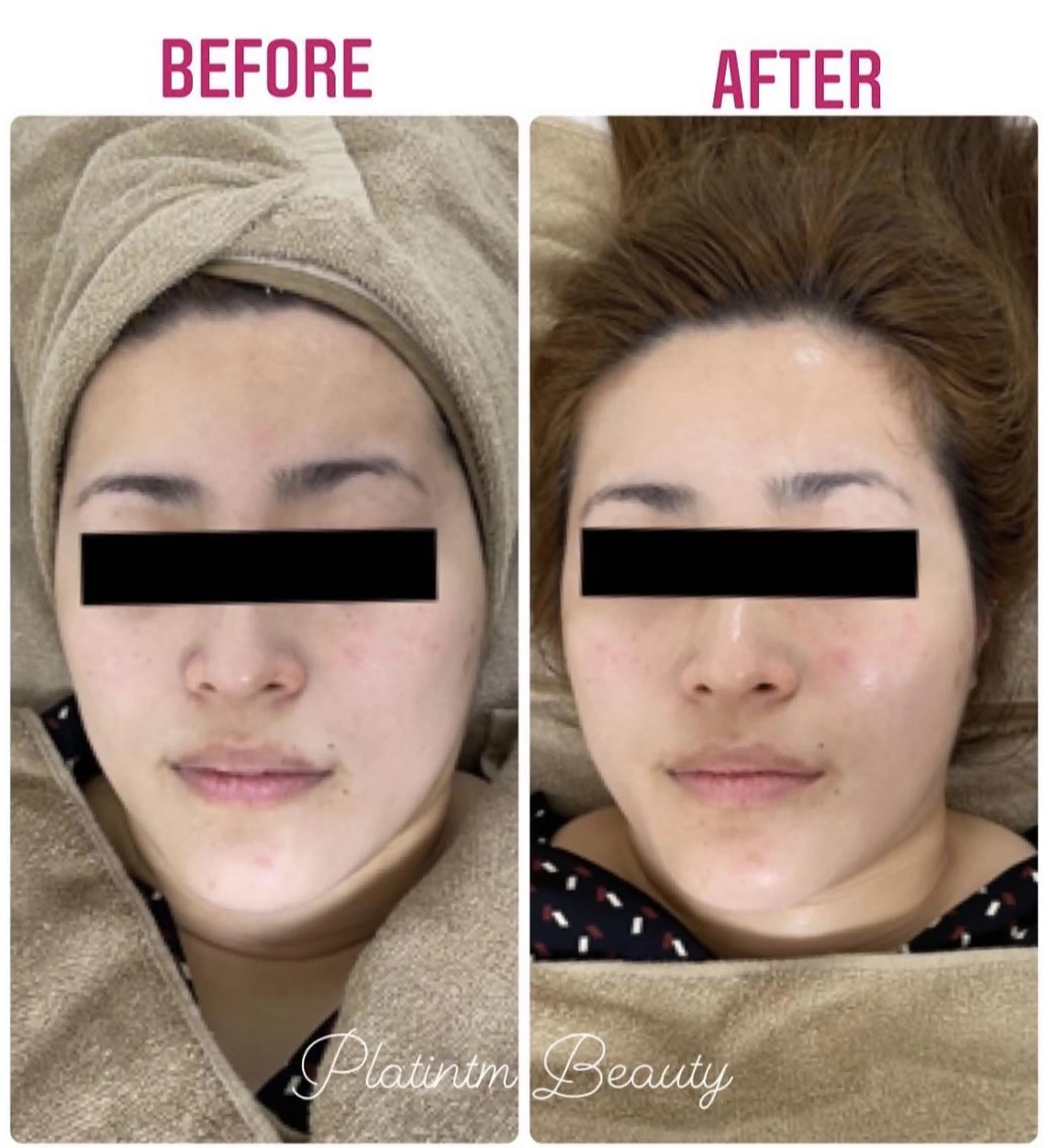 エステ プラティーヌ ボーテ【もものり】のその他イメージ