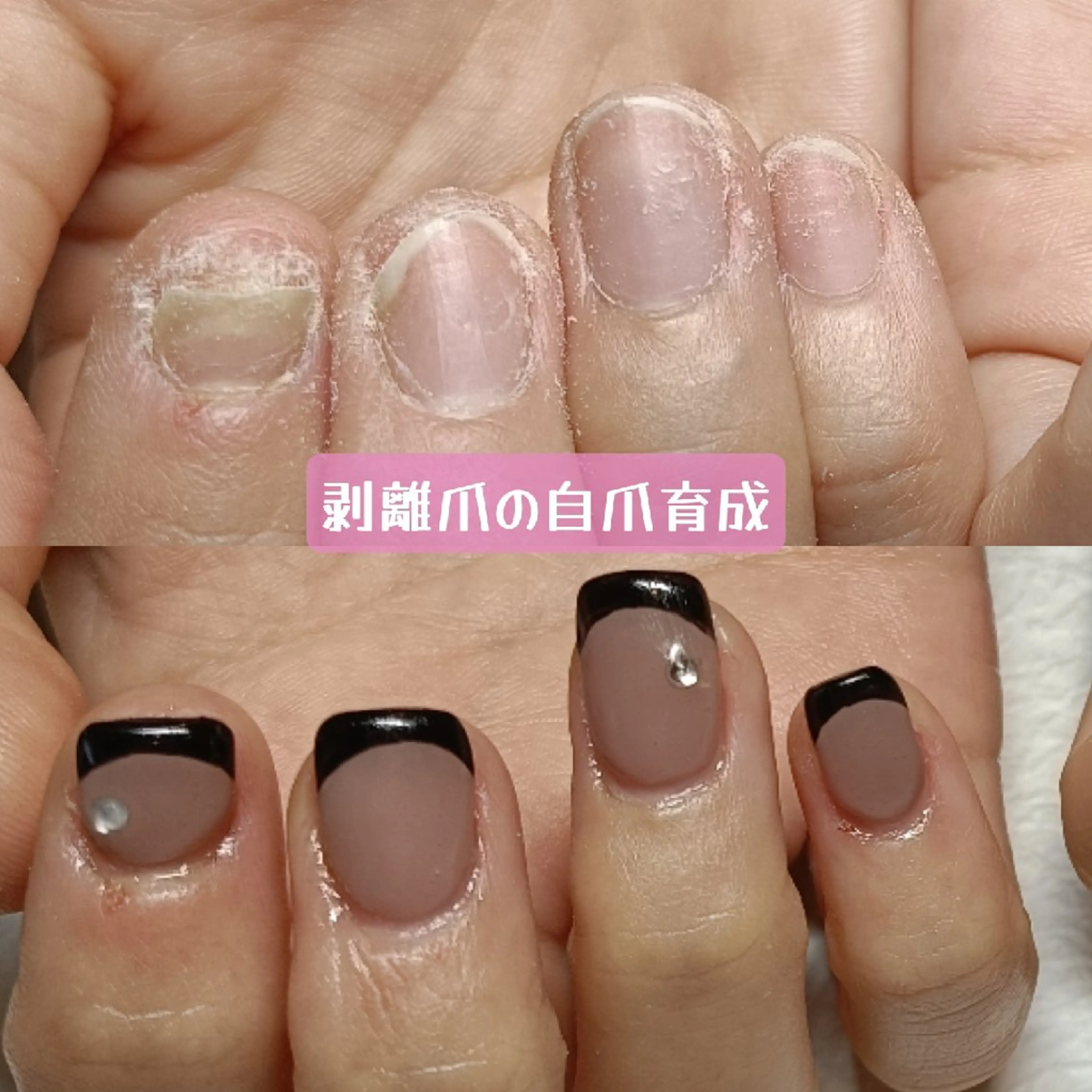ネイル フレンチネイル ストーンネイル ハンドネイル ハンドケア 深爪矯正/爪育成ケア manie nailのネイルデザイン