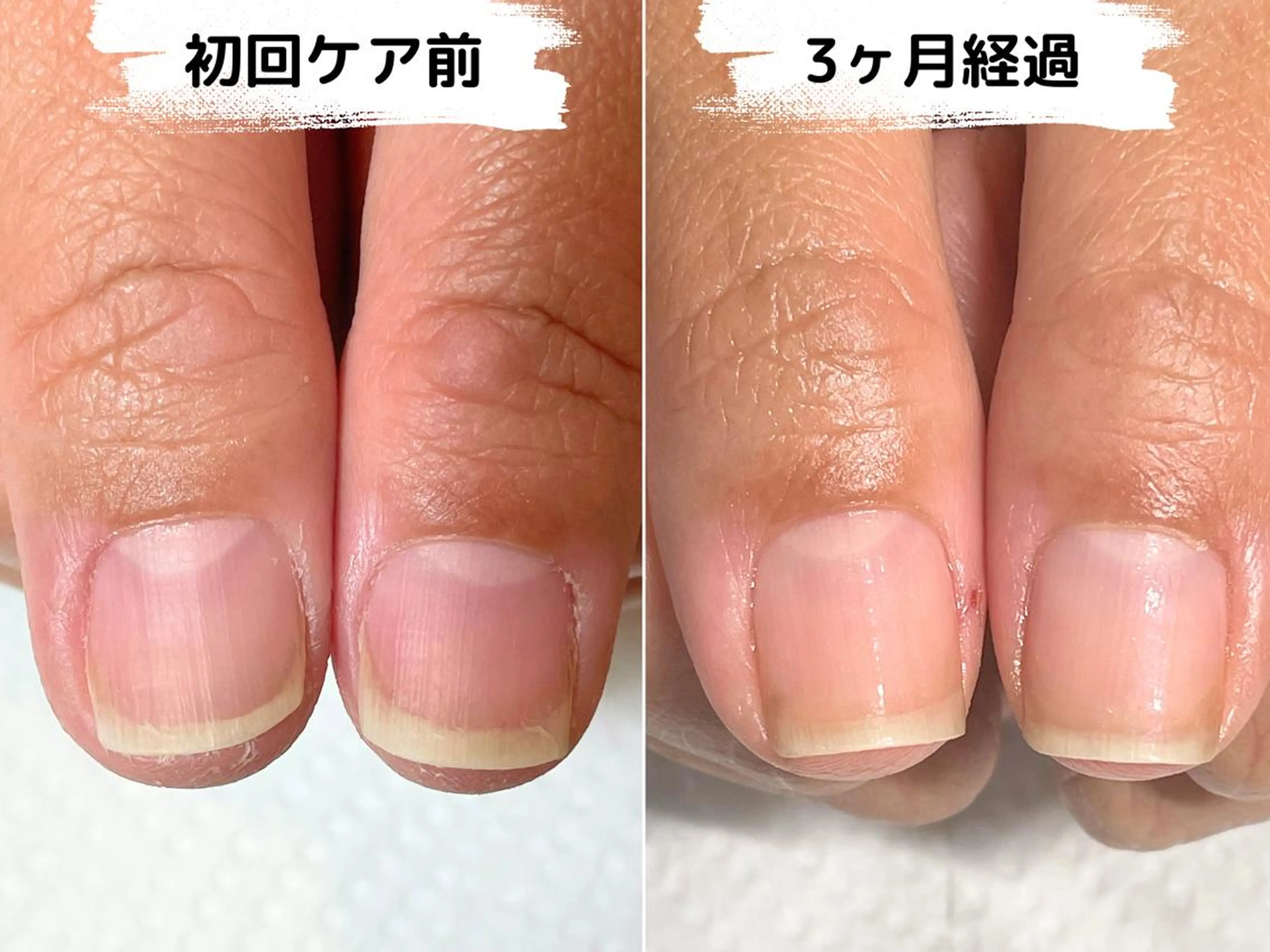 ネイル ハンドケア Ka pilina所属・自爪育成専門店 Kapilinaのネイルデザイン