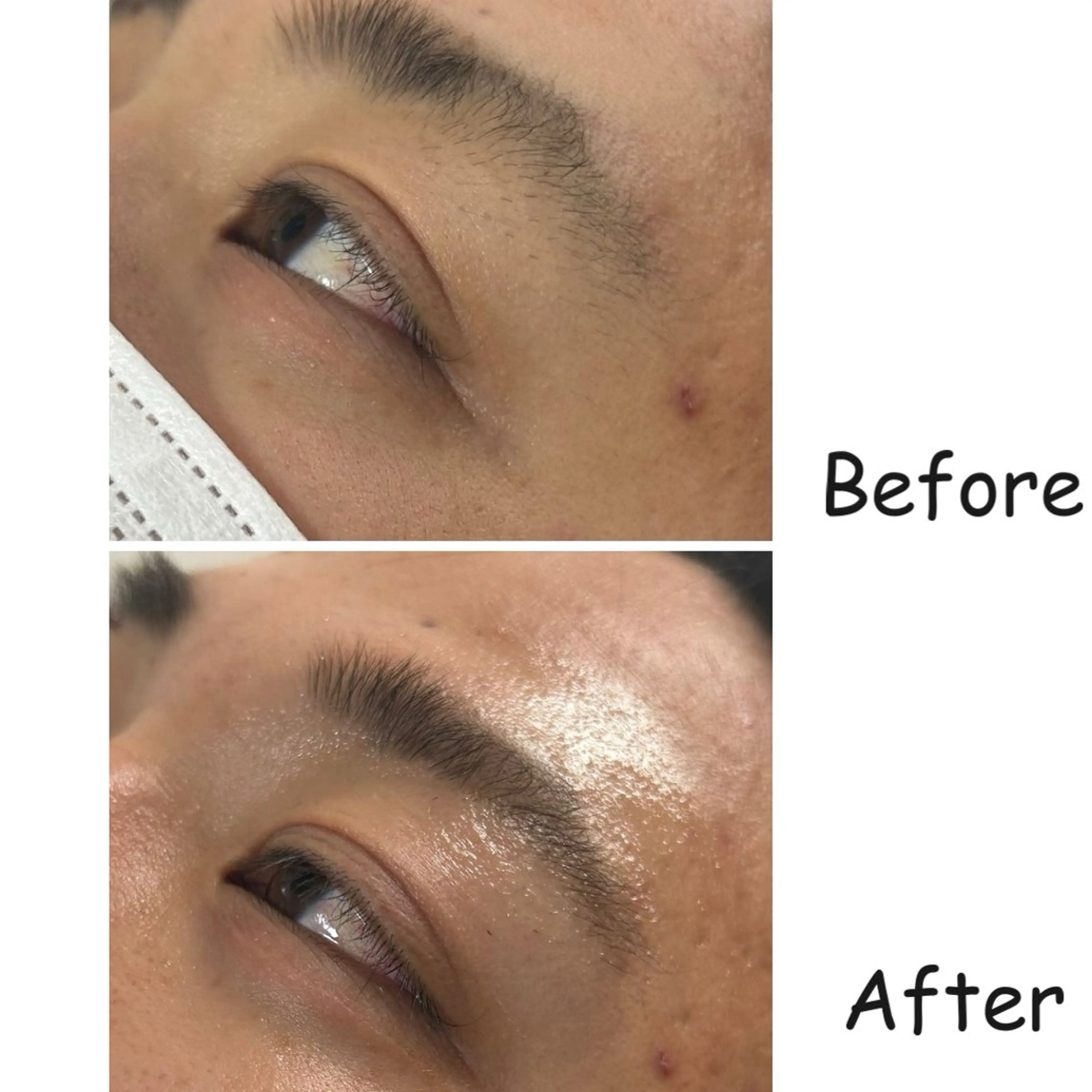 メンズ ワックス脱毛 エマニエル USAのその他イメージ