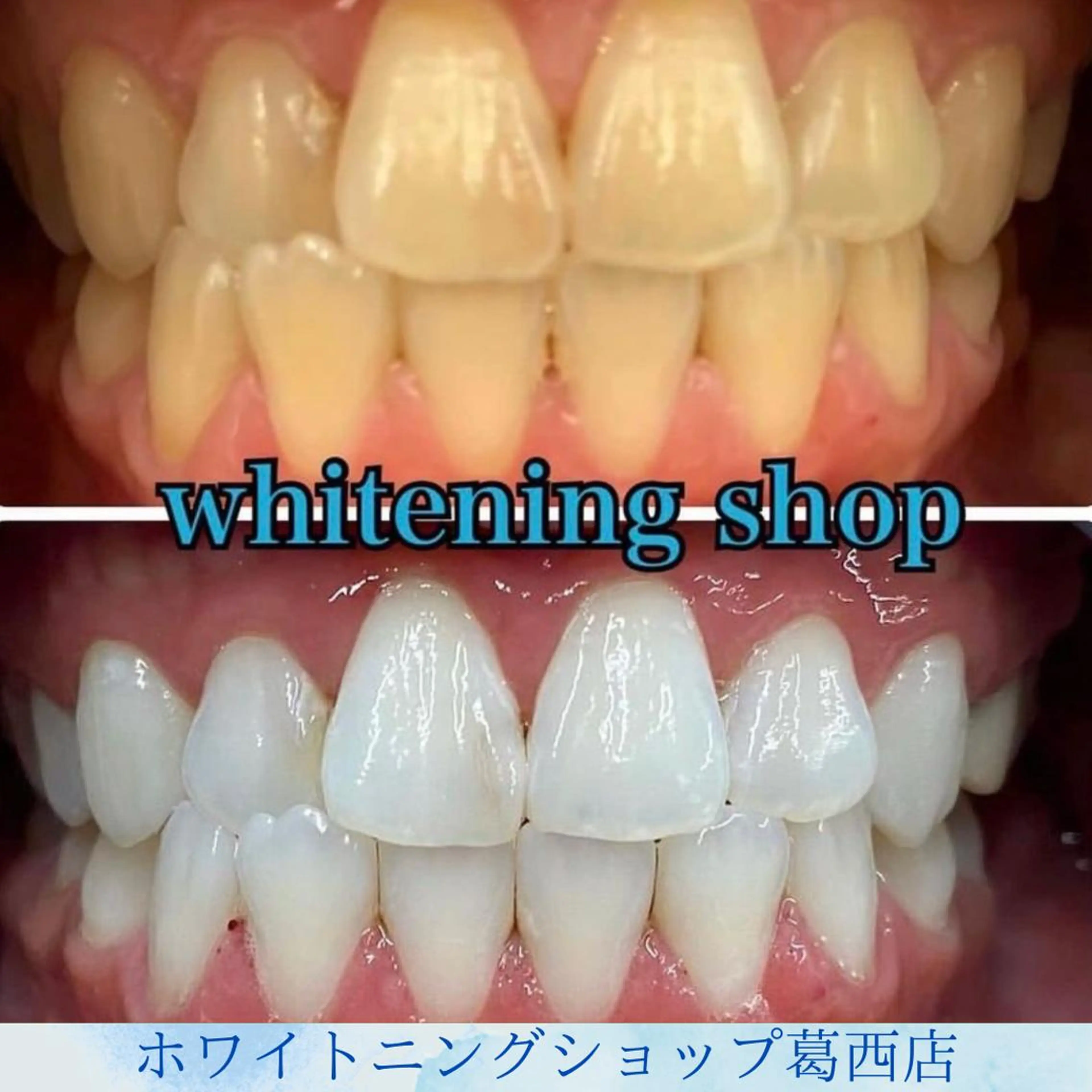 その他 ホワイトニング ショップ葛西店のその他イメージ