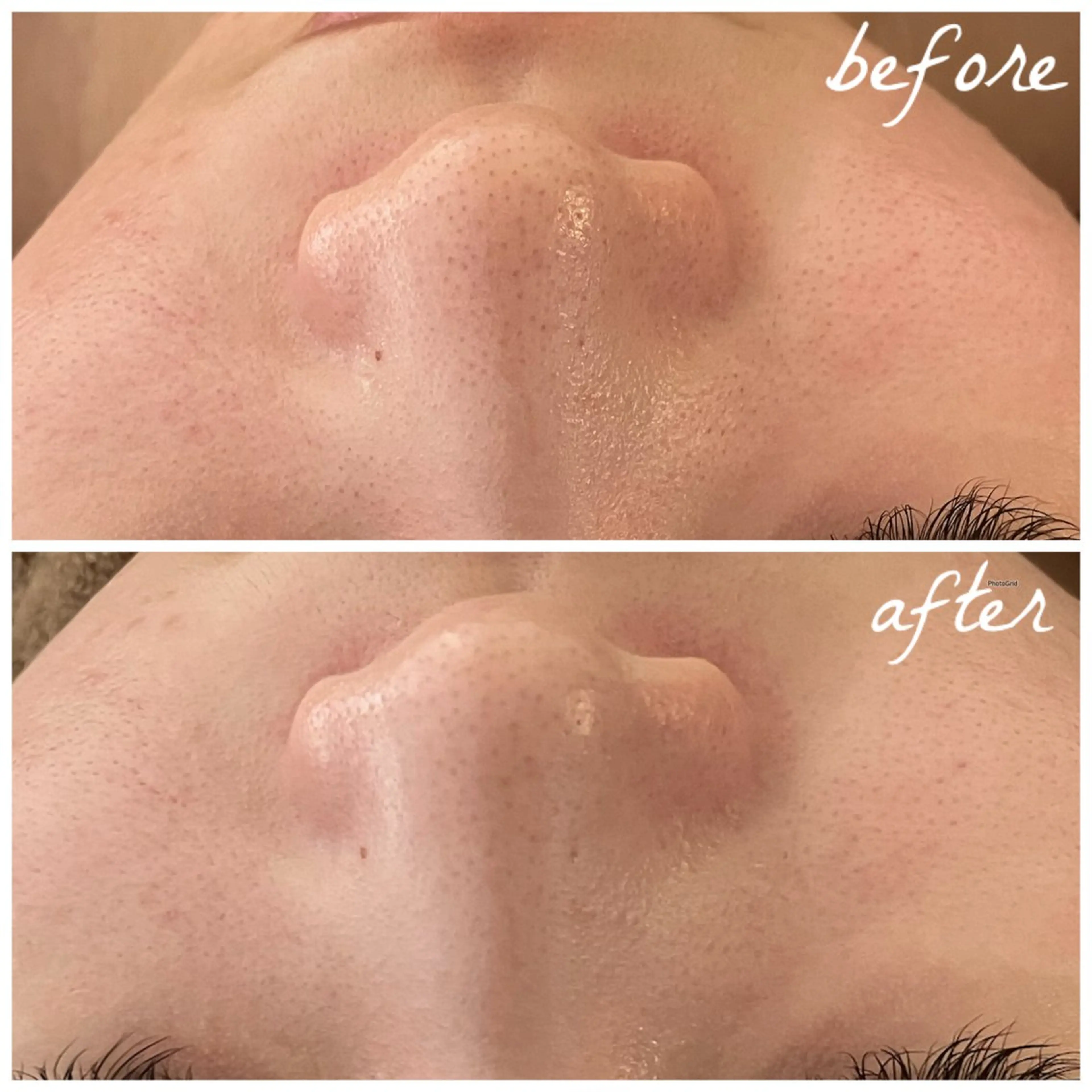 メンズ エステ メナード岐阜茜部 杉浦のエステ・リラクイメージ