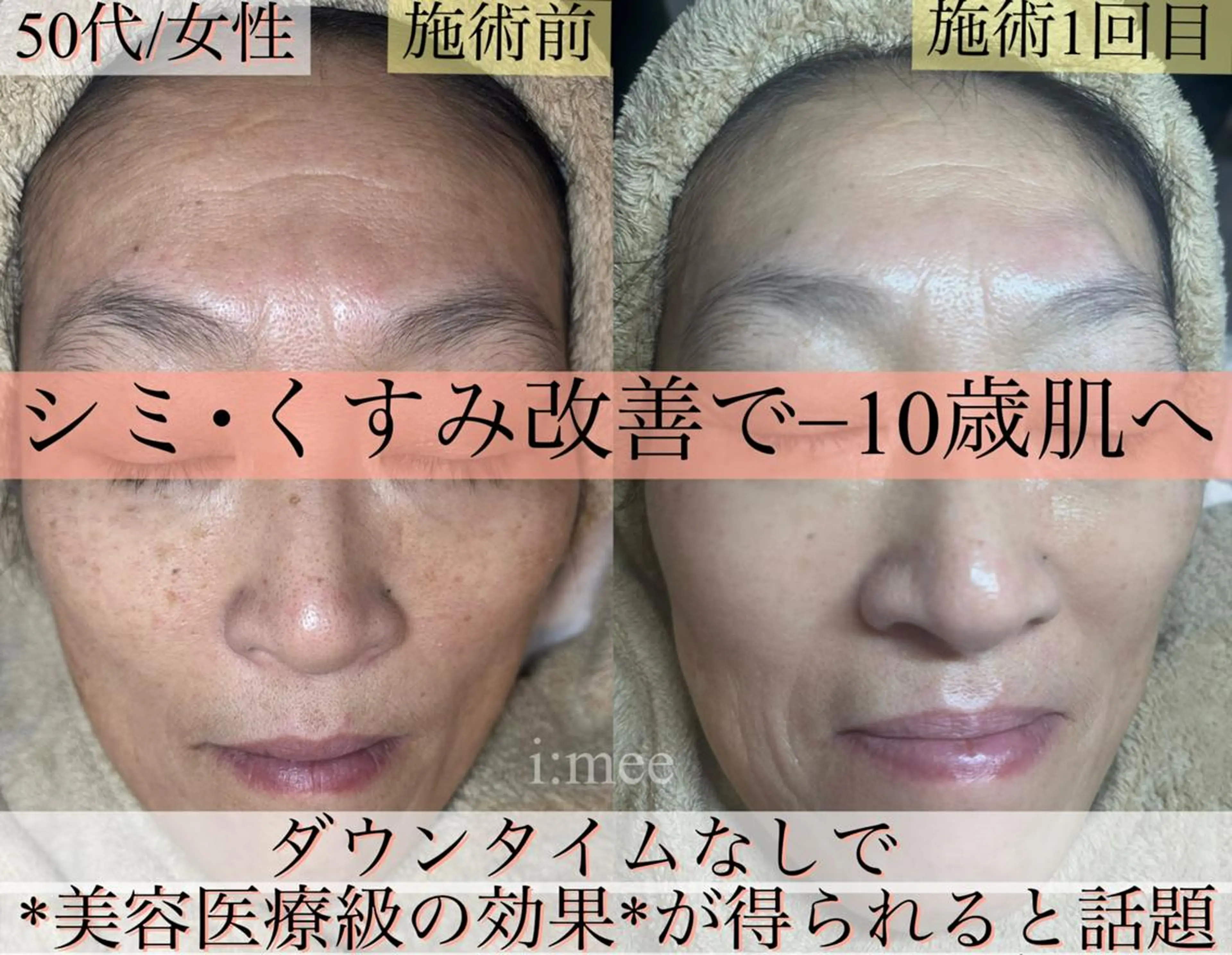 エステ 森 叶愛のエステ・リラクイメージ