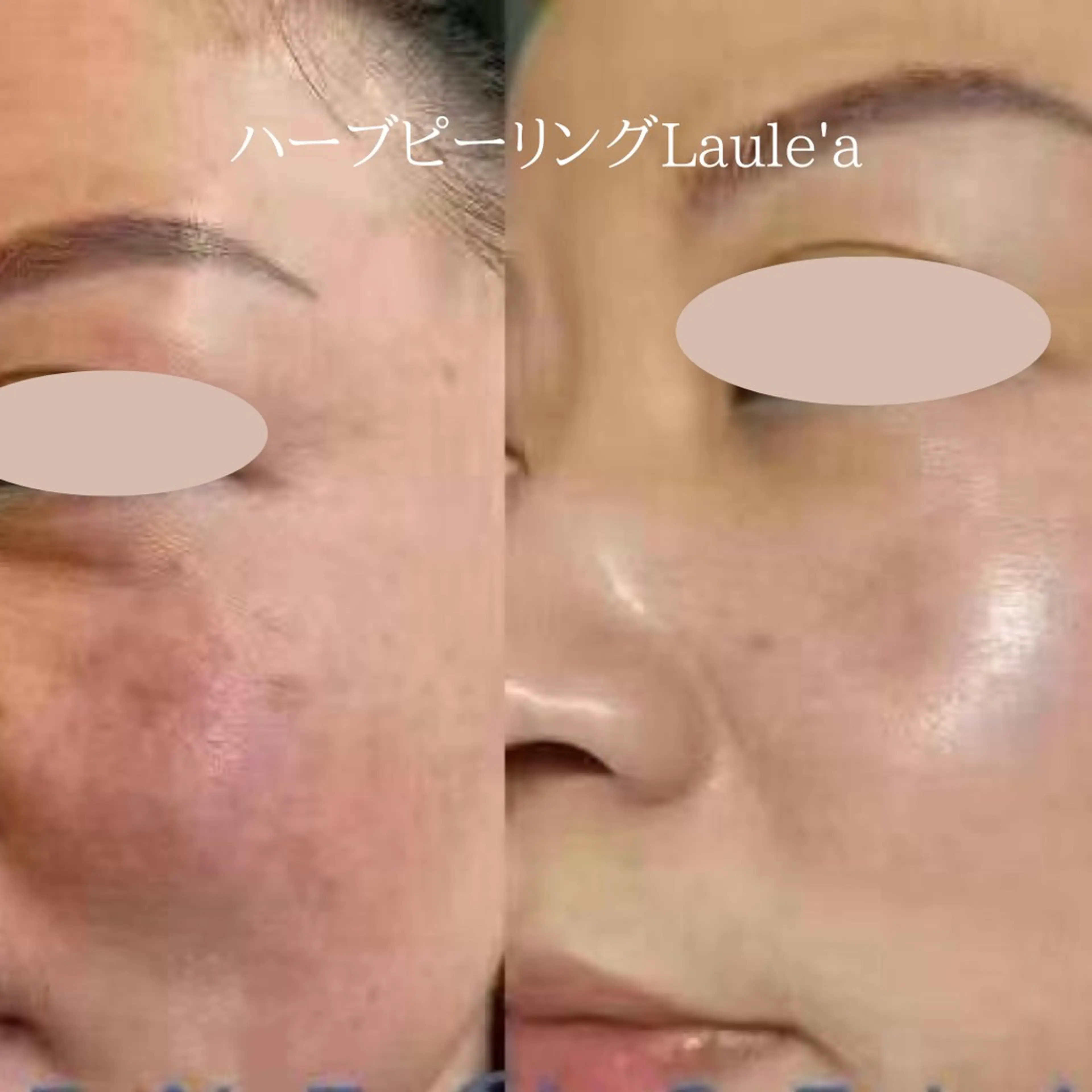 痩身/腸もみ/ ヘッドスパ/リンパのエステ・リラクイメージ