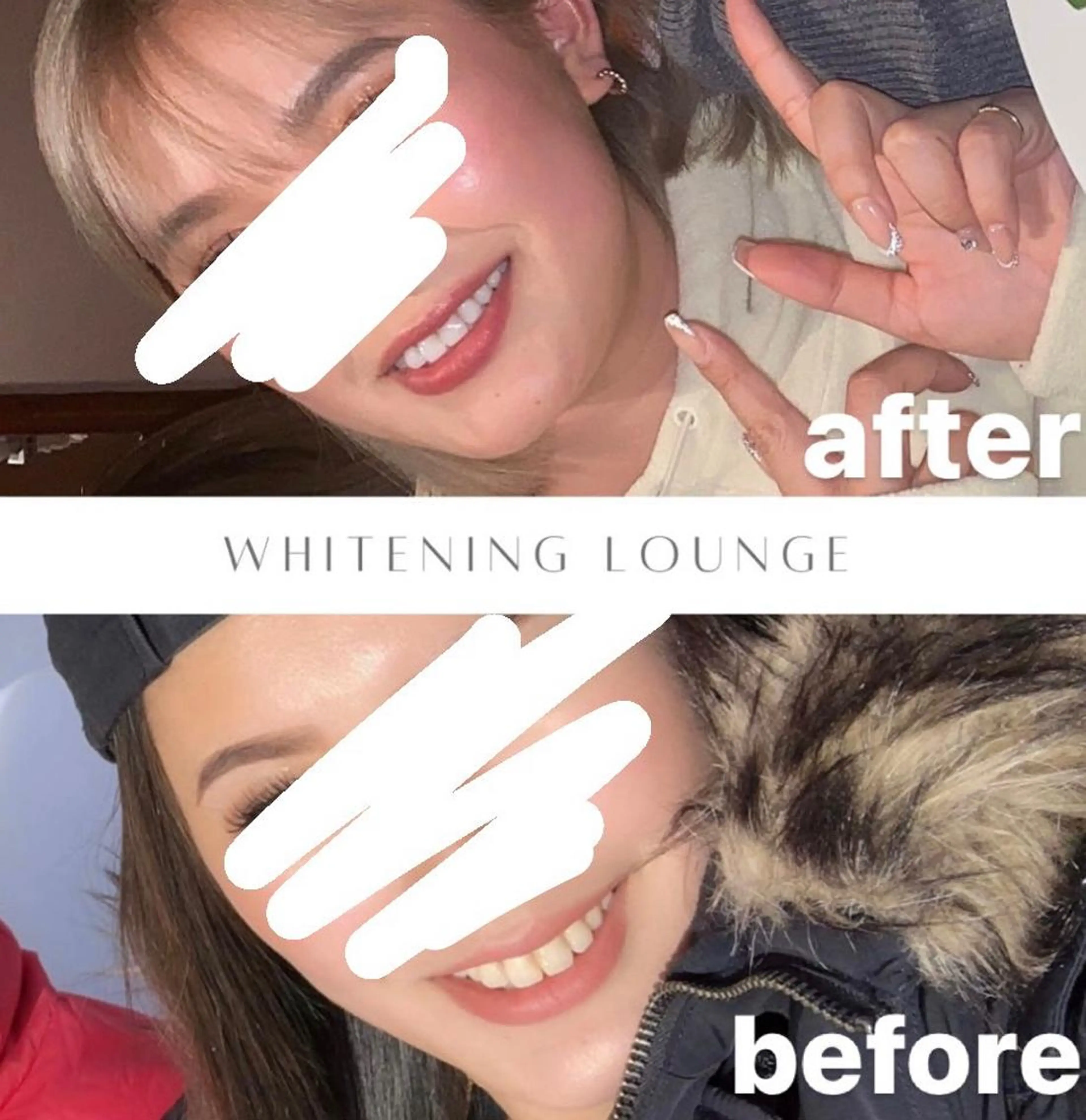 その他 ホワイトニングラウンジ横須賀所属・ホワイトニング Lounge横須賀のその他イメージ