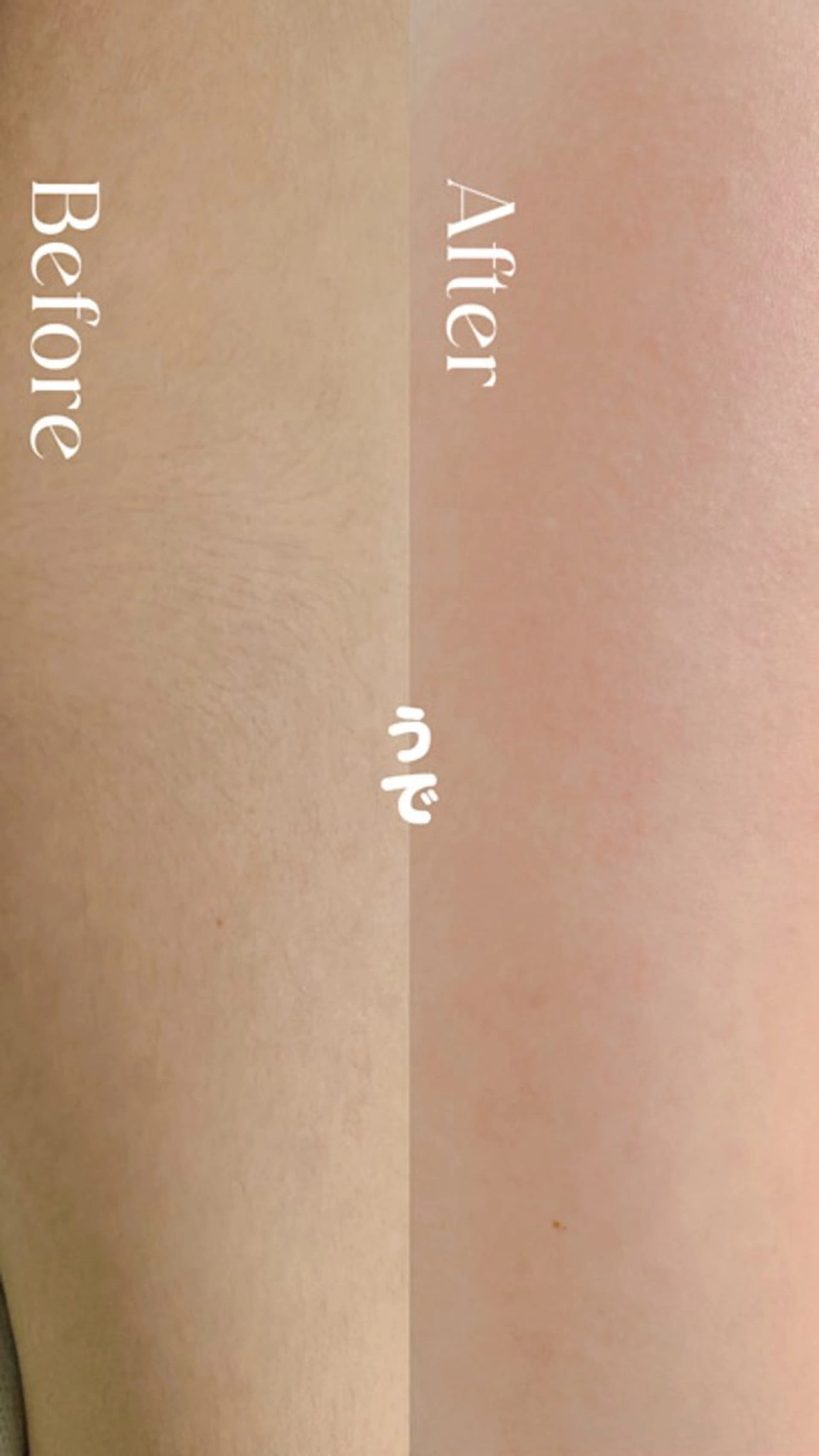 Hit. シュガーリング豊橋のエステ・リラクイメージ