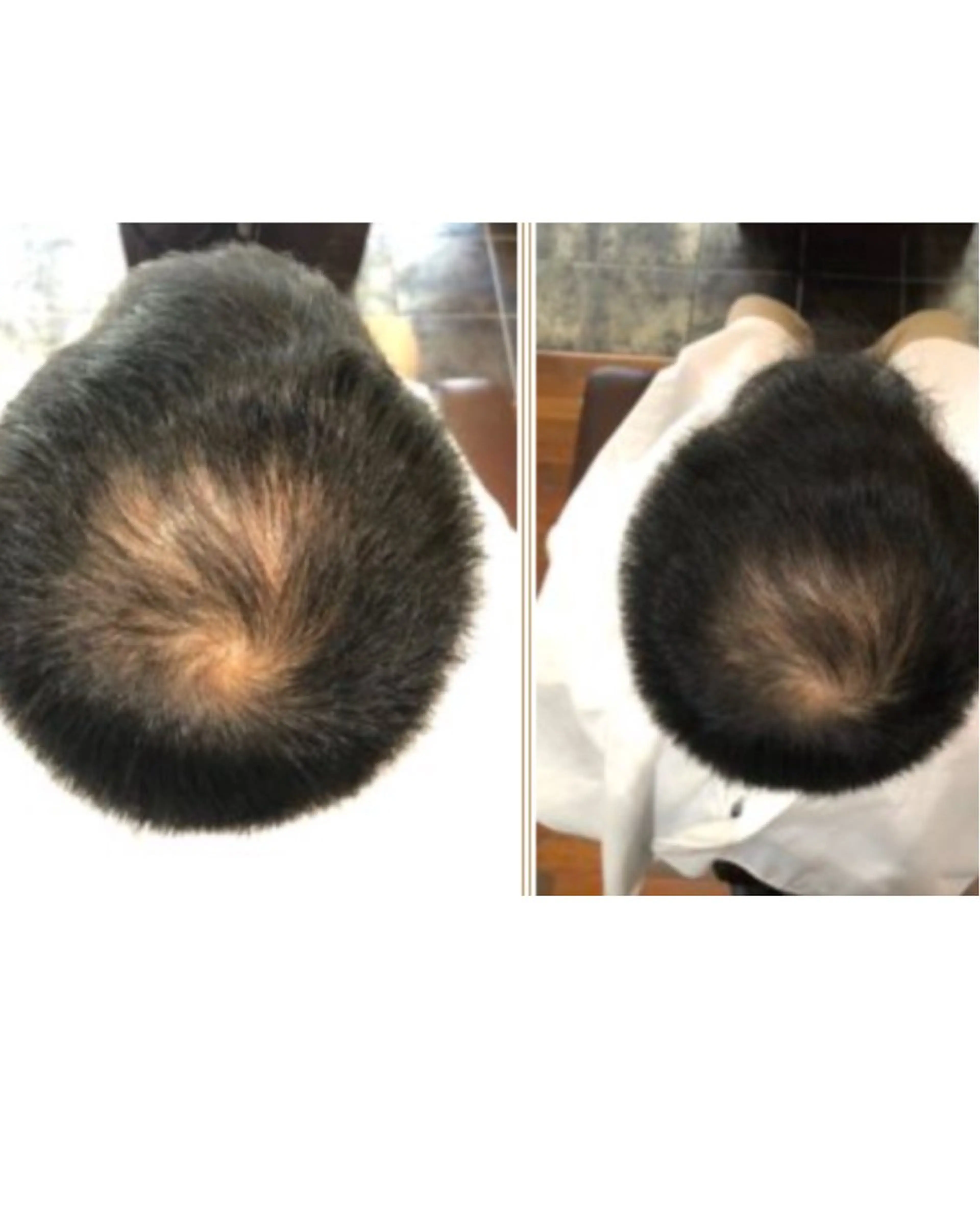40代からの髪悩み 専門美髪アドバイザーのヘアスタイル