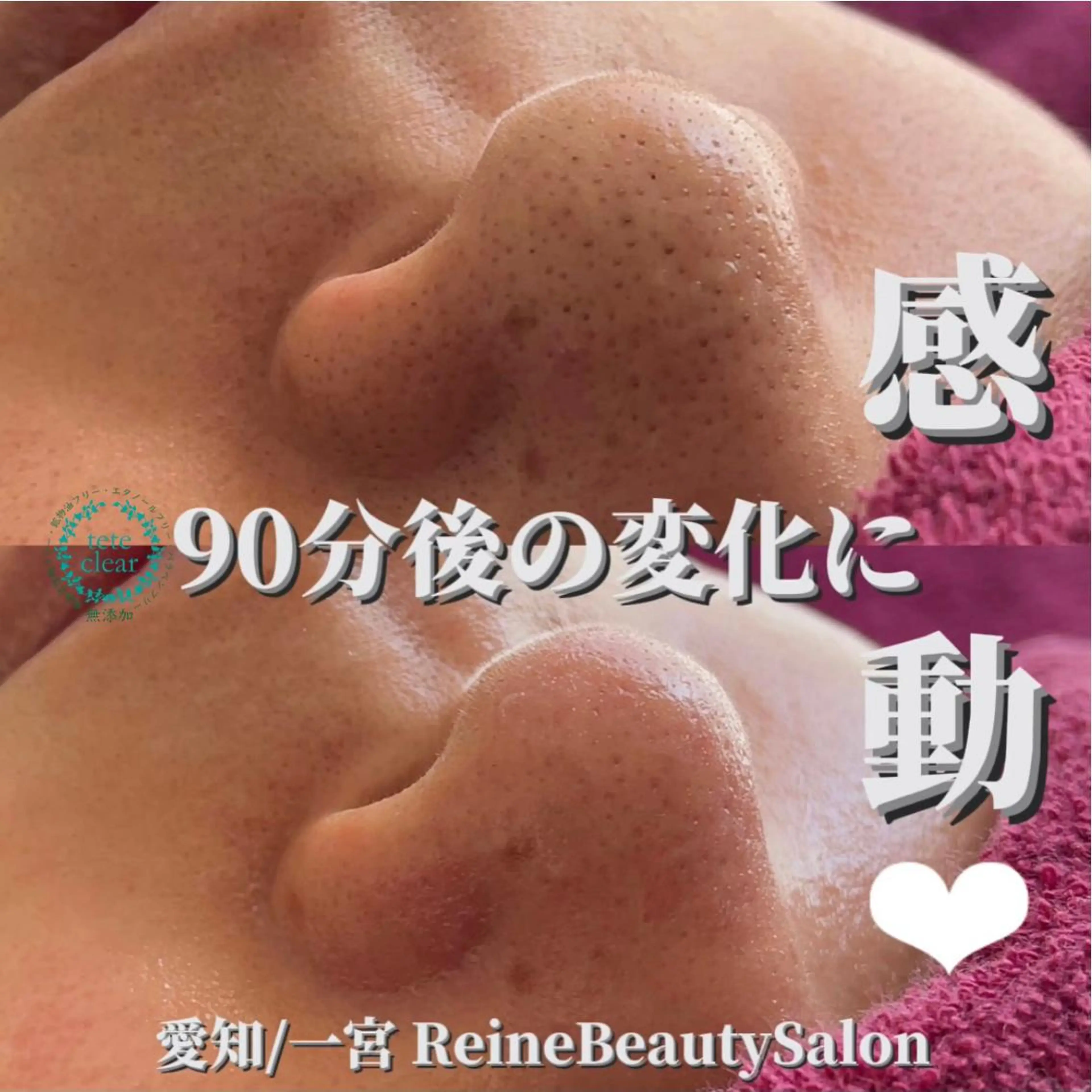 エステ Reine BeautySalon所属・毛穴/シミ肝斑/脱毛 横山梨里のエステ・リラクイメージ
