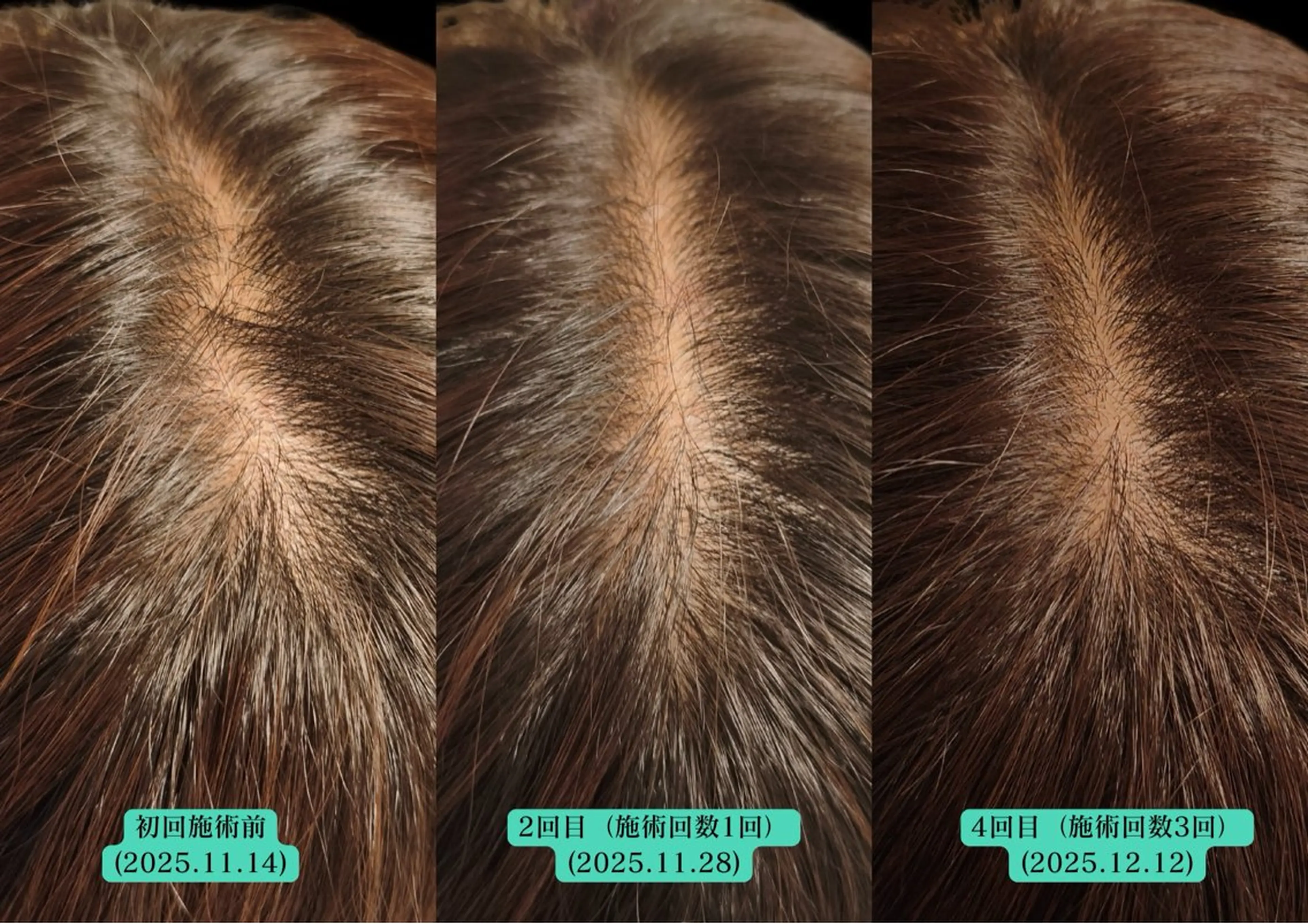 エステ リラク 美容とカラダの鍼灸 サロン やなけんのエステ・リラクイメージ