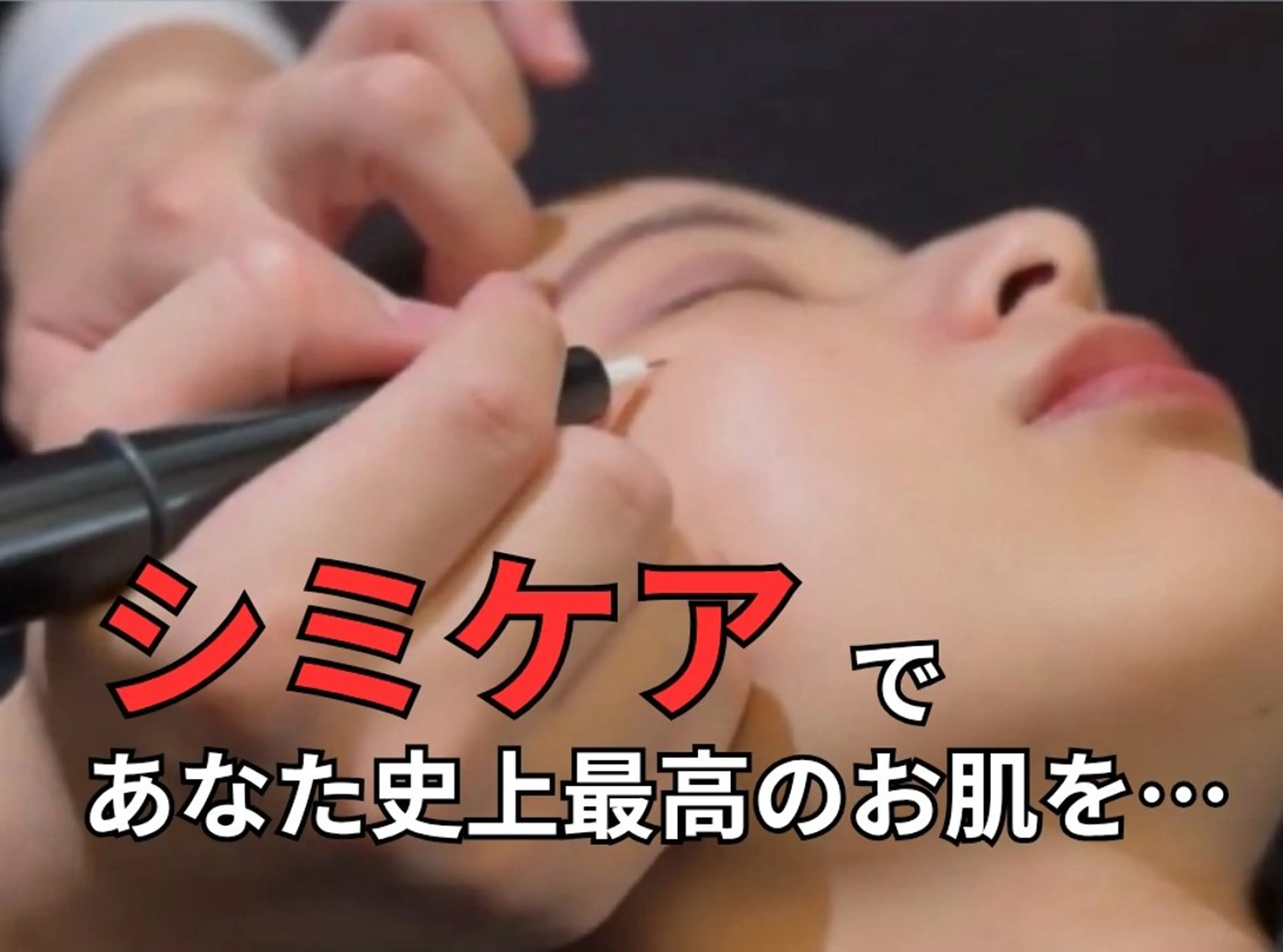 【レーザーが苦手な方必見！】低周波シミケアマシンの写真