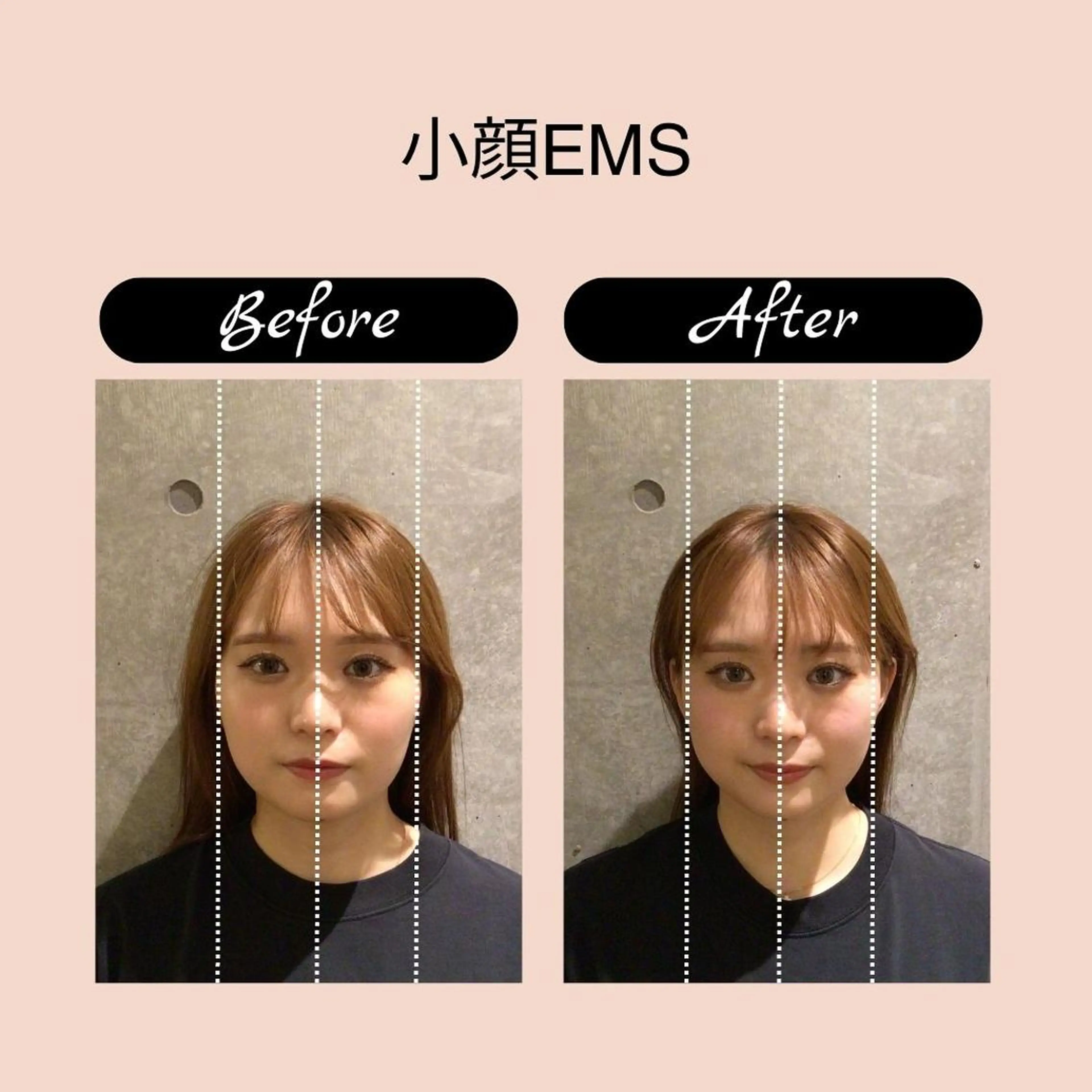 恵比寿/小顔/矯正 美容整体師⭐︎Aiのエステ・リラクイメージ