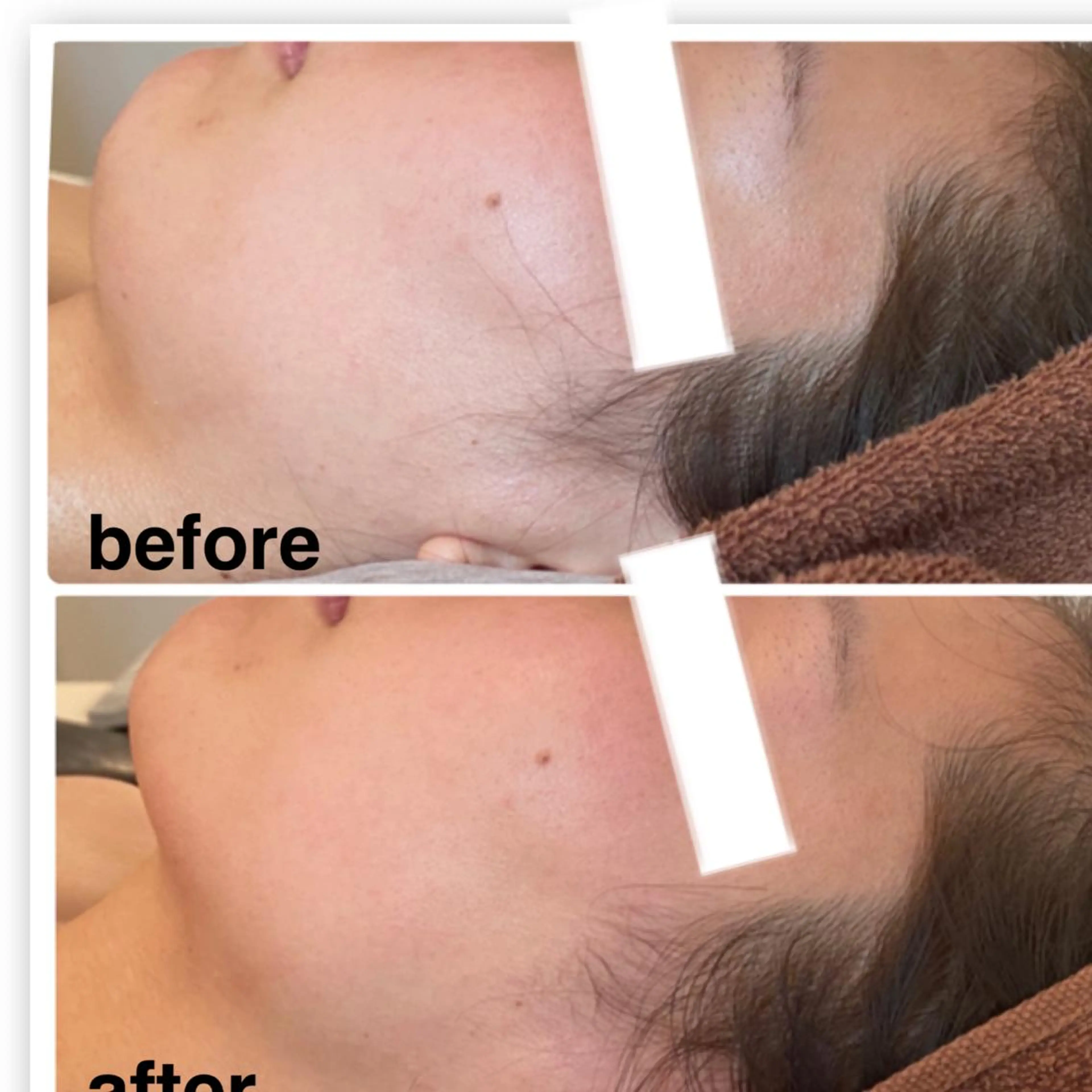 FLEUR大阪・整体 ・ハイフ・痩身・小顔のエステ・リラクイメージ