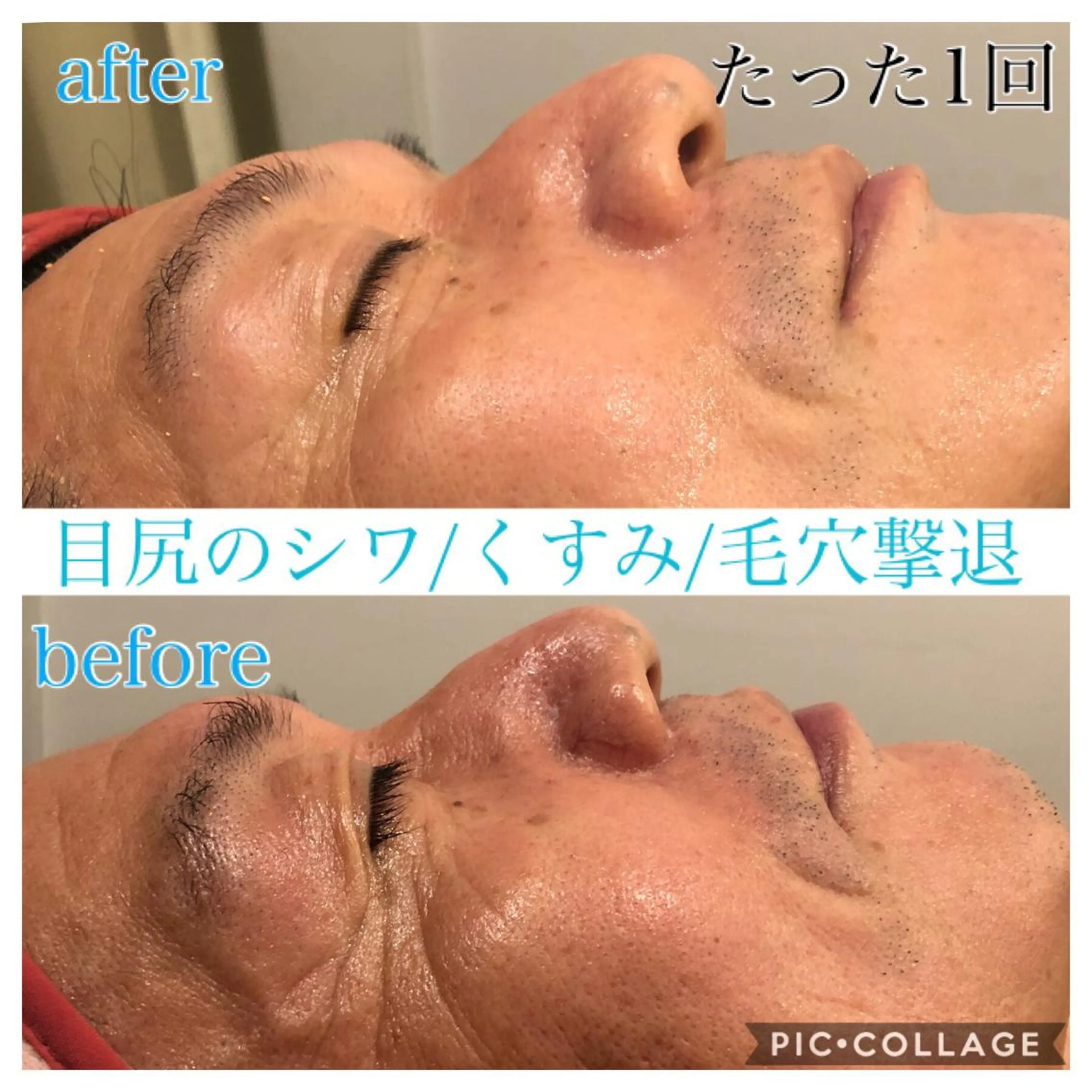 ショート カラー パーマ ヘアアレンジ キッズ ネイル マツエク・マツパ エステ リラク Ensor Clair所属・EnsorClair 代表 野口真央のエステ・リラクイメージ