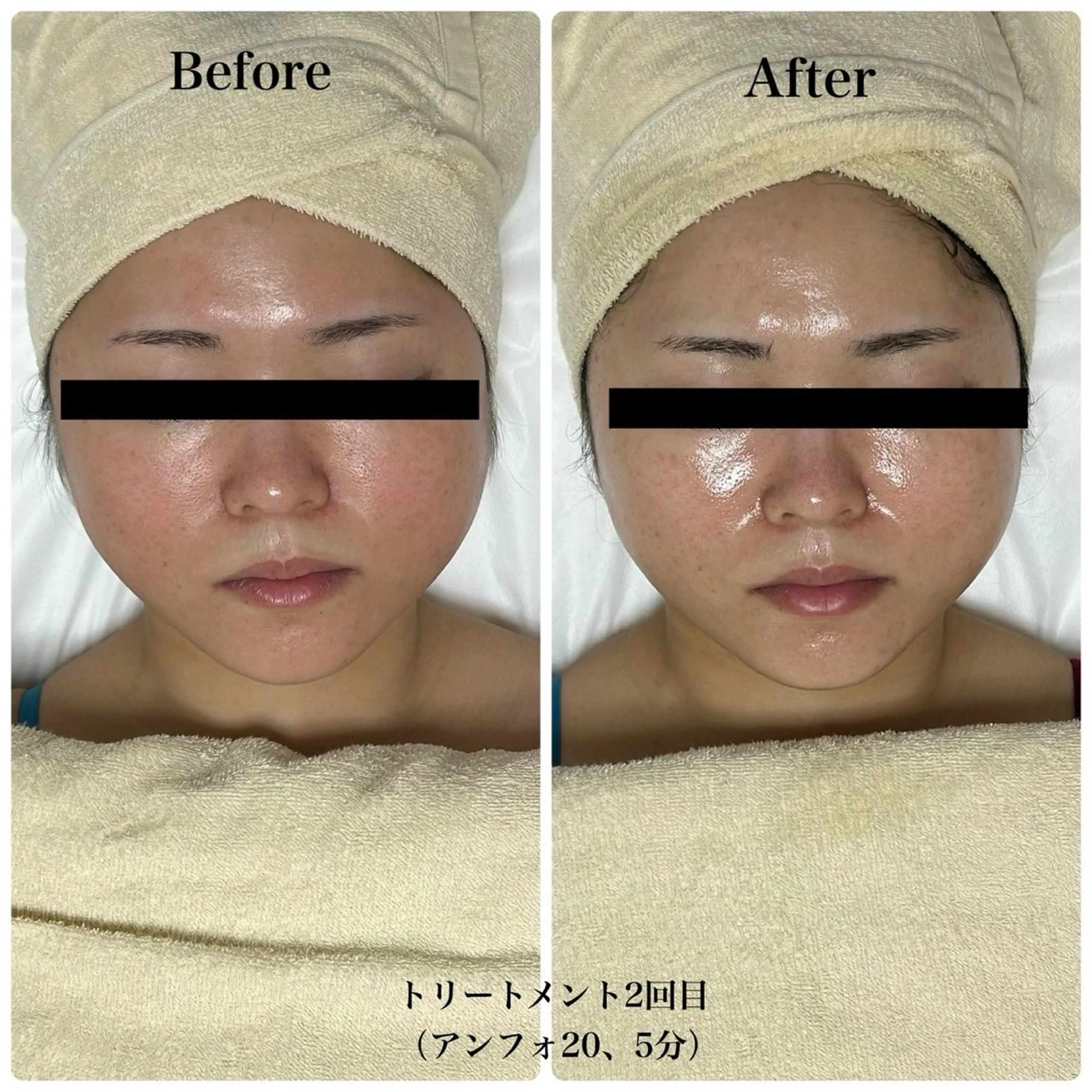 エステ リラク 脱毛サロン エクボ 高瀬のエステ・リラクイメージ