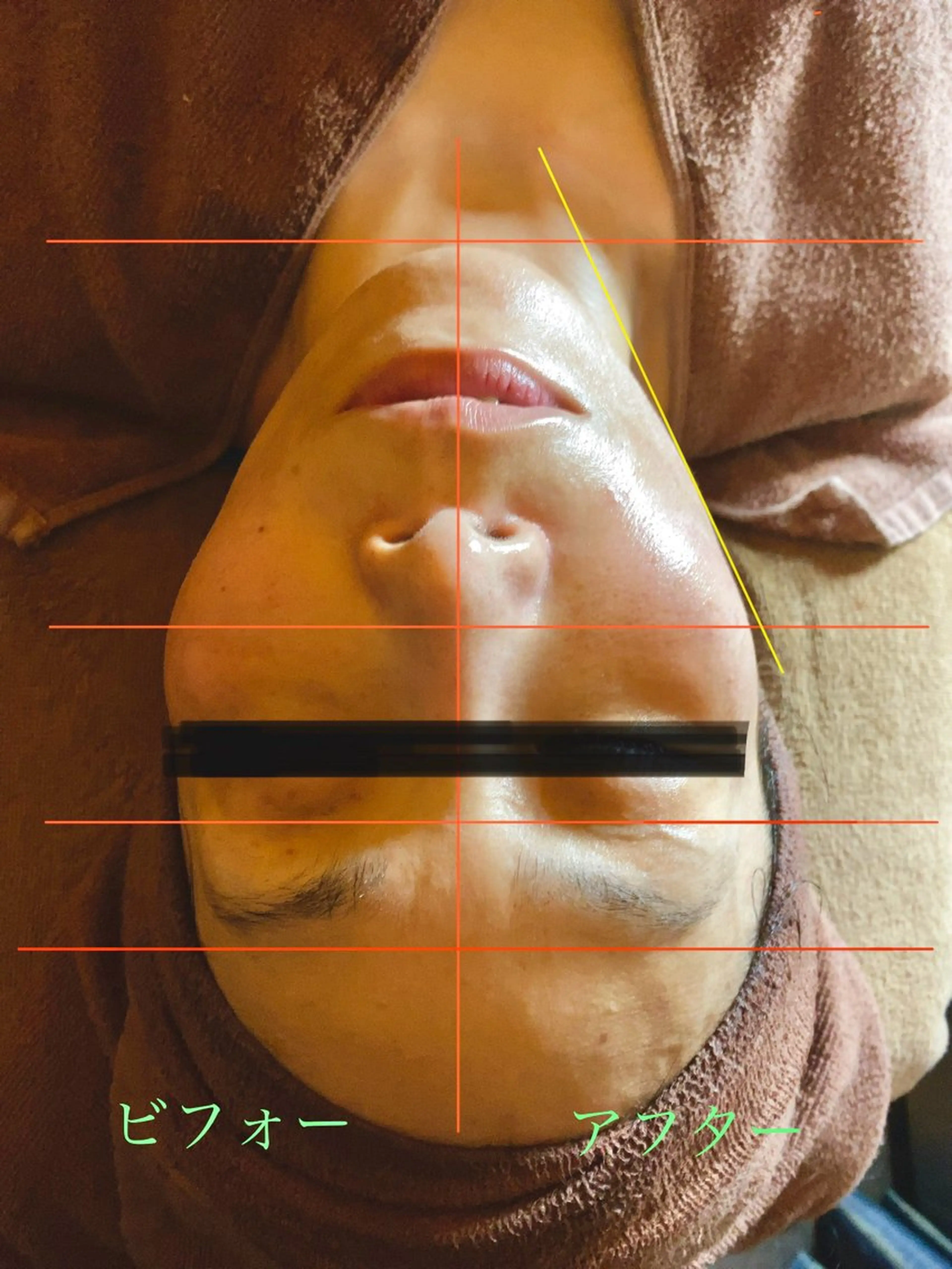 エステ ビューティーラウンジ A&A✨佐藤✨のエステ・リラクイメージ