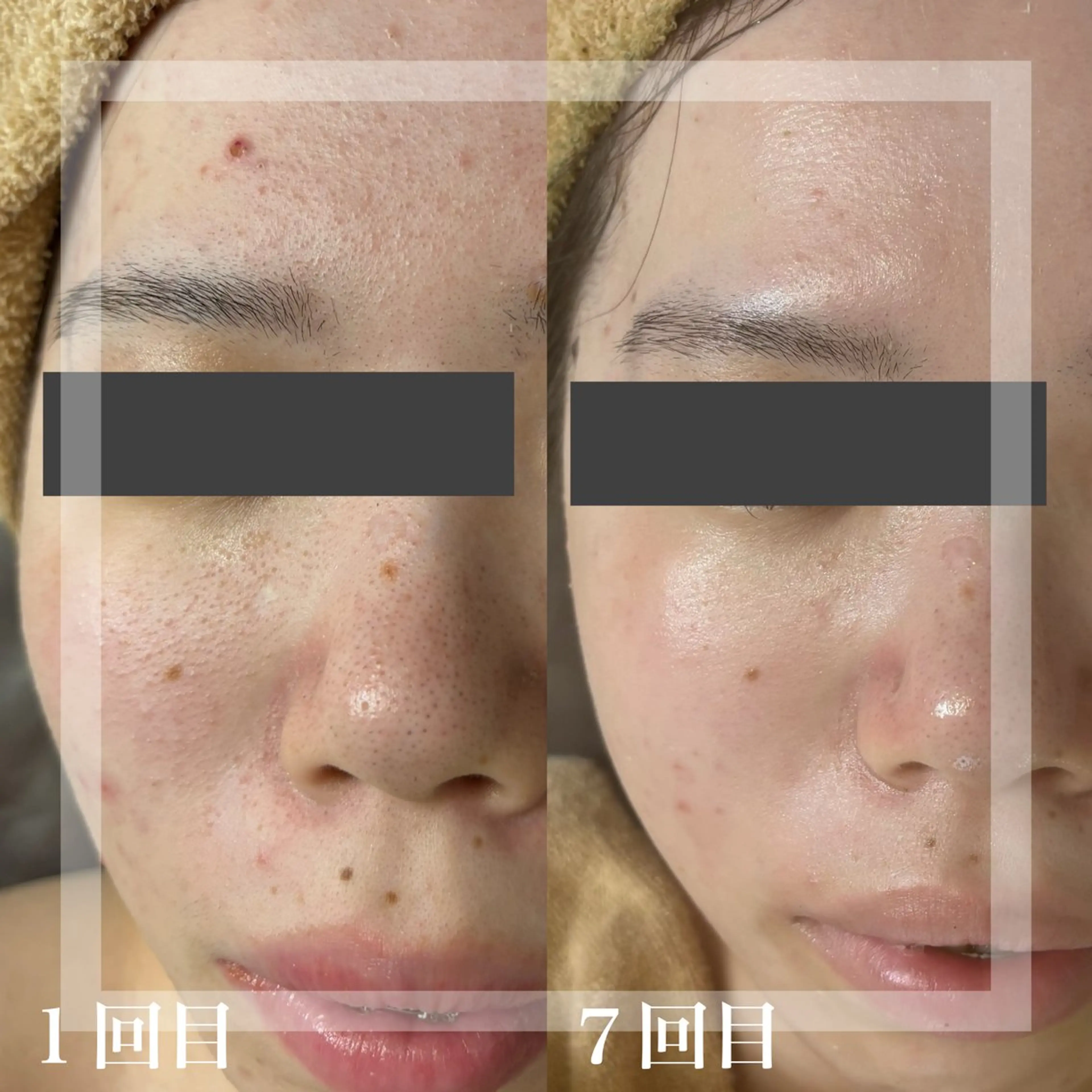 エステ WHITE AQUA 北千住店のエステ・リラクイメージ