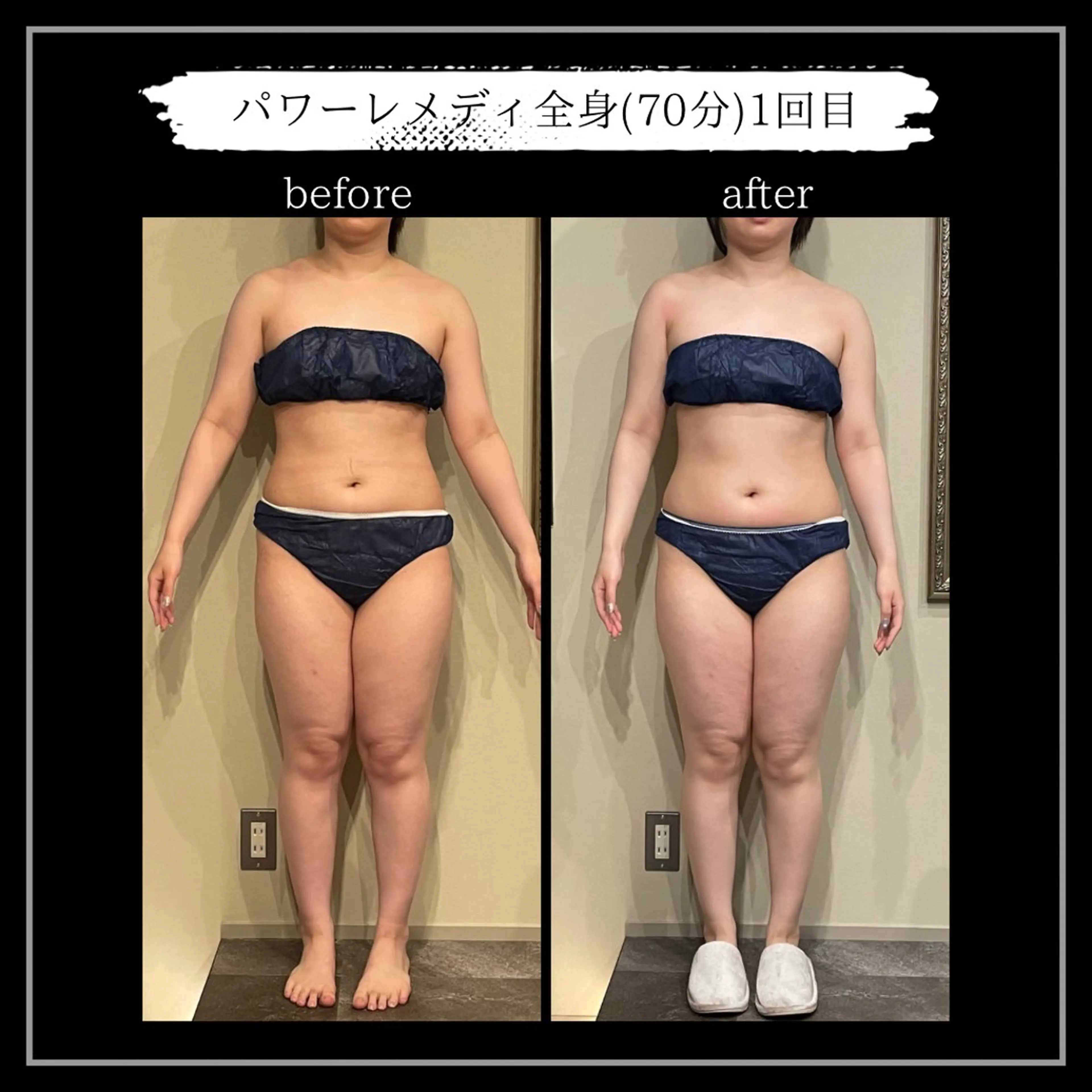 オフ:オン所属・オフ:オン 全身筋膜マッサージのエステ・リラクイメージ