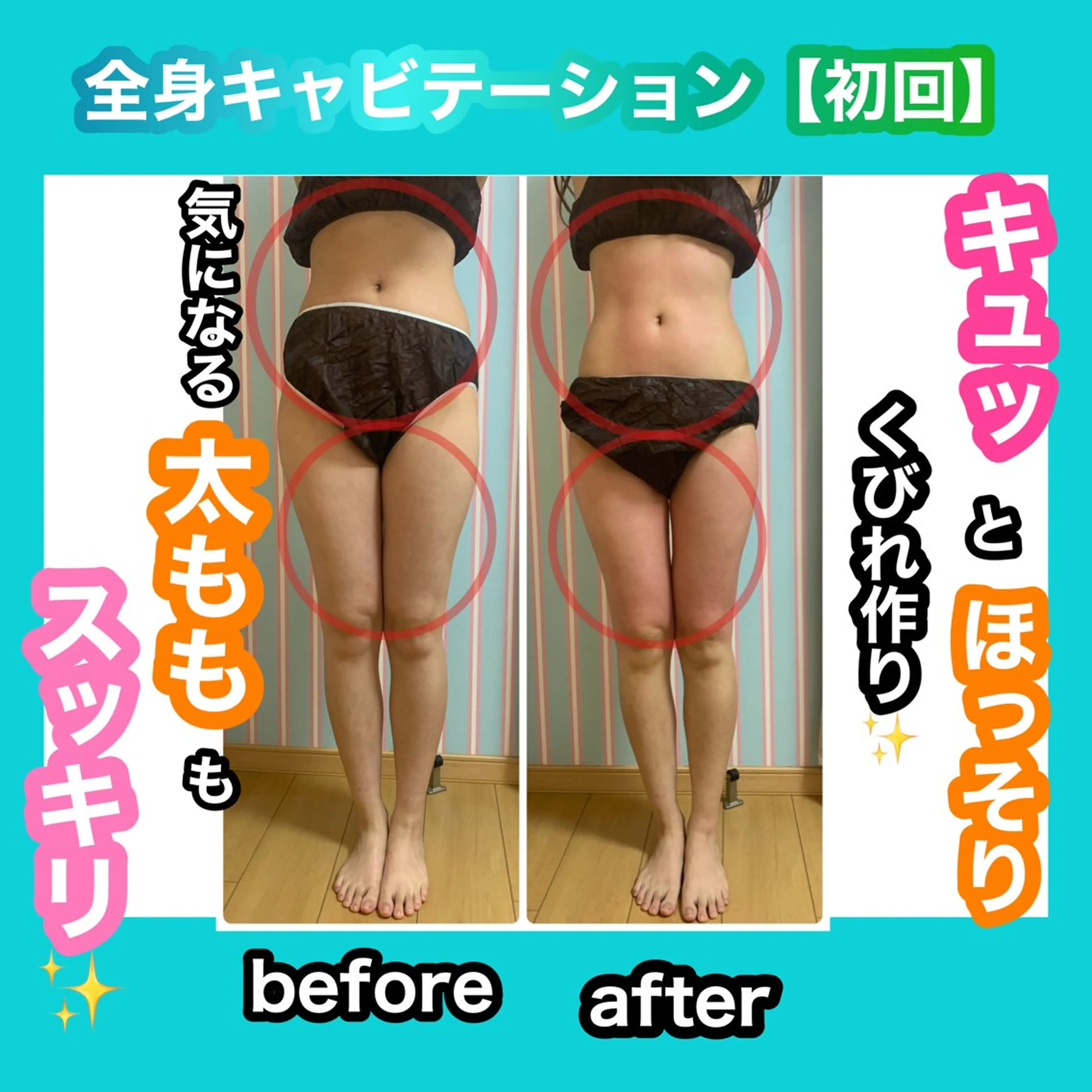 エステ リラク 痩身/脱毛/ネイル HARUKAのエステ・リラクイメージ