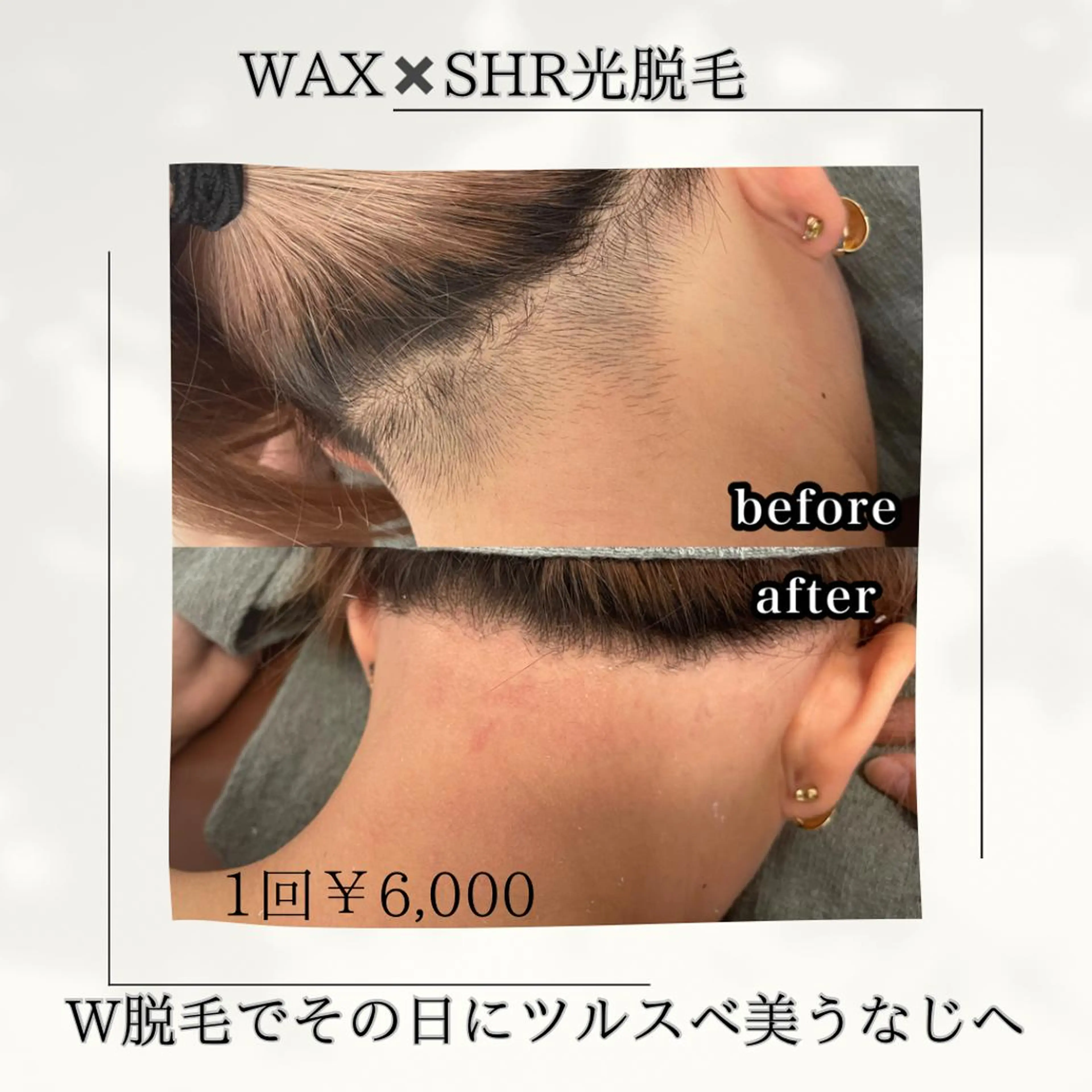 脱毛 Salon Improveのネイルデザイン