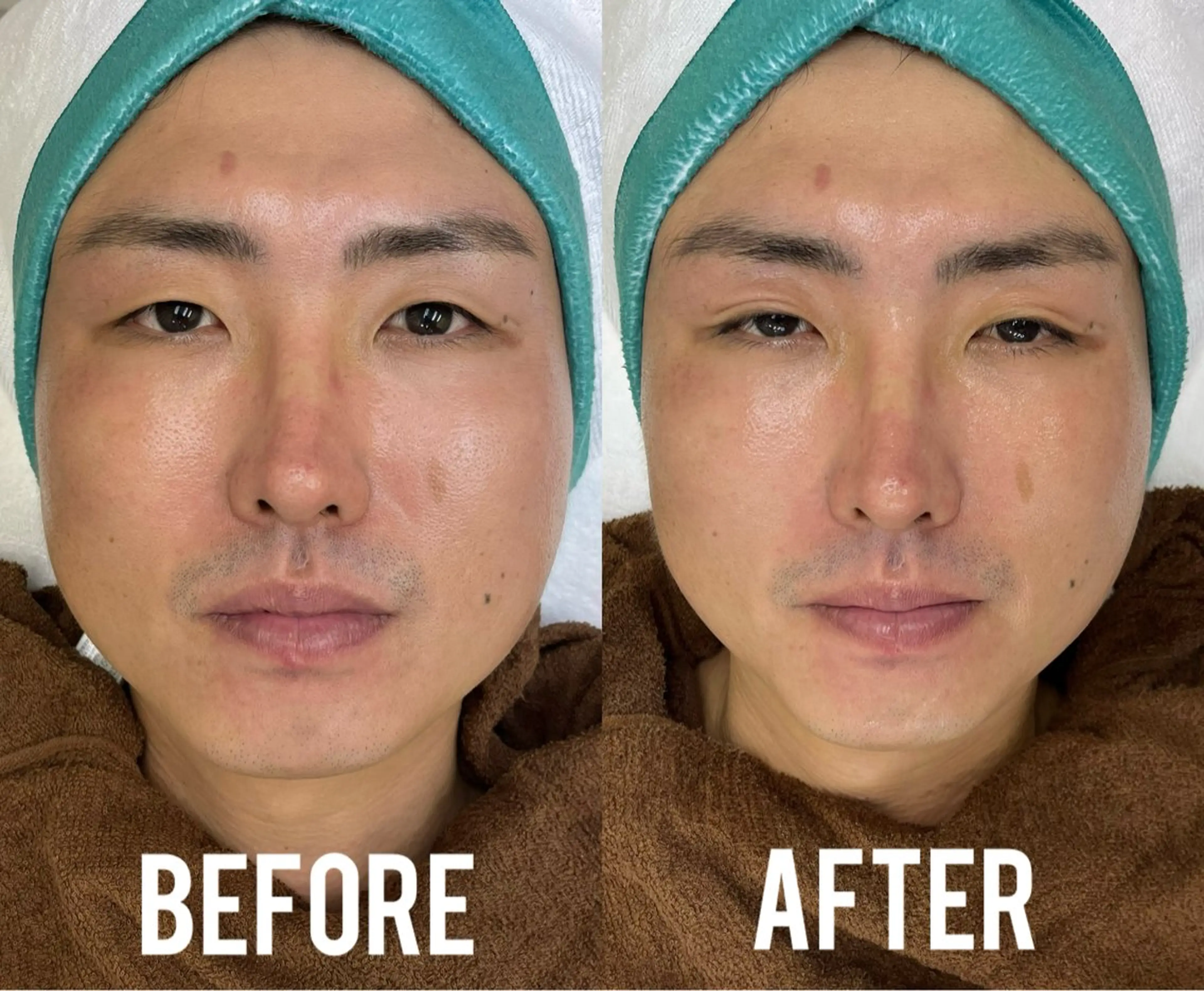 エステ MEITY新宿所属・小顔、毛穴ケア MEITY新宿のエステ・リラクイメージ