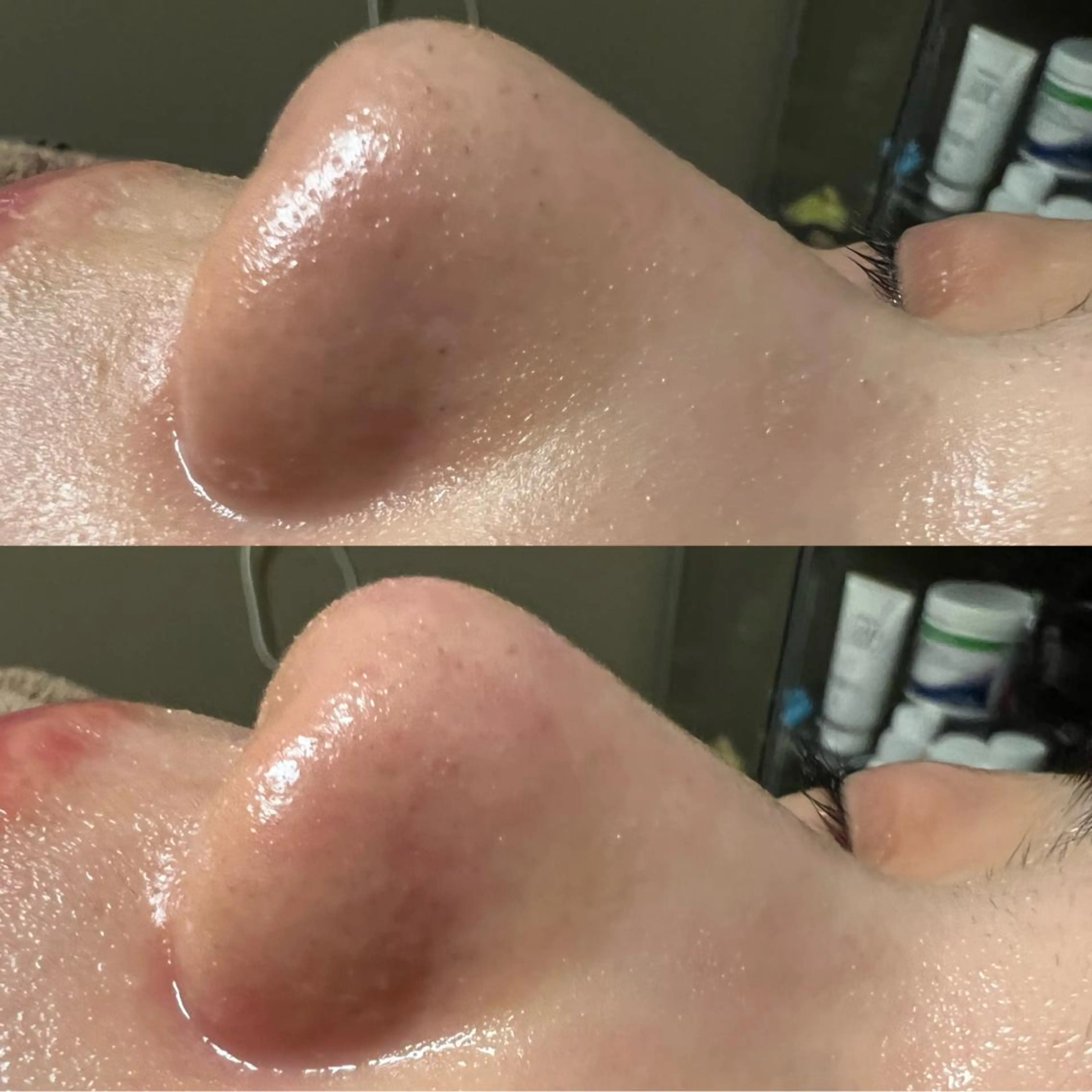 lymph care 'Welnəsのエステ・リラクイメージ