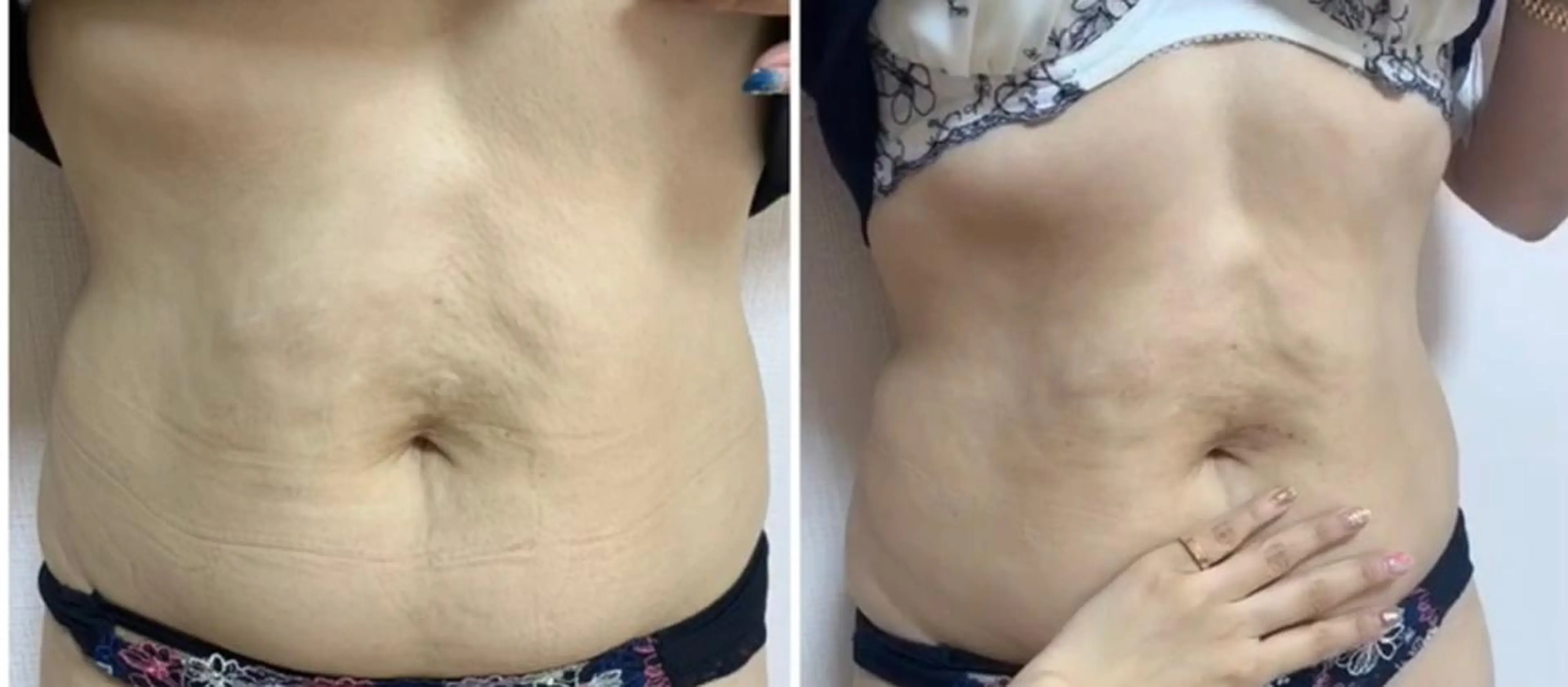 aliaハイフ&水光ジェットサロン所属・aliaハーブ水光店 エステティシャン募集のエステ・リラクイメージ