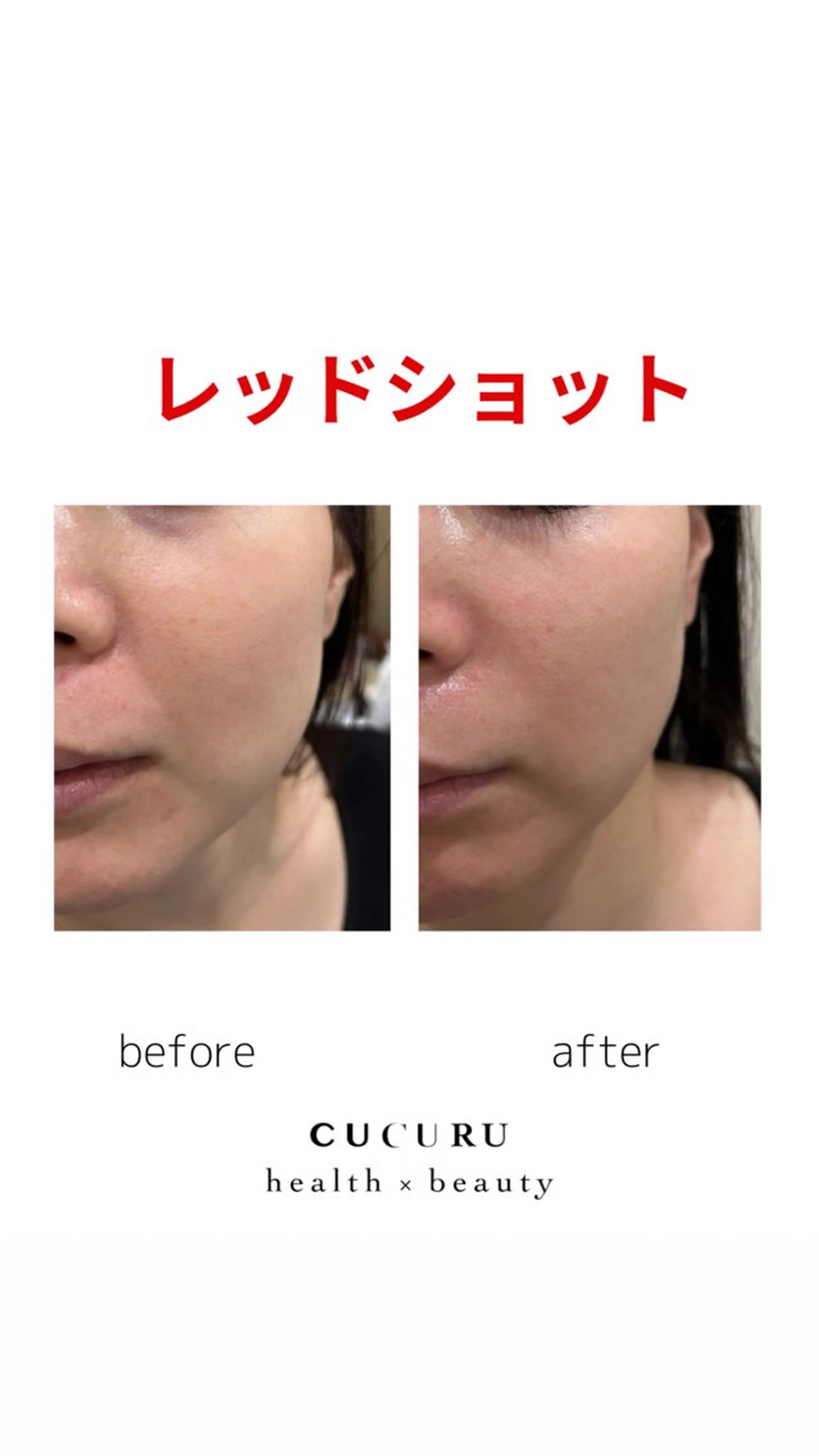 CUCURU health×beauty所属・CUCURU hea lth×beautyのエステ・リラクイメージ