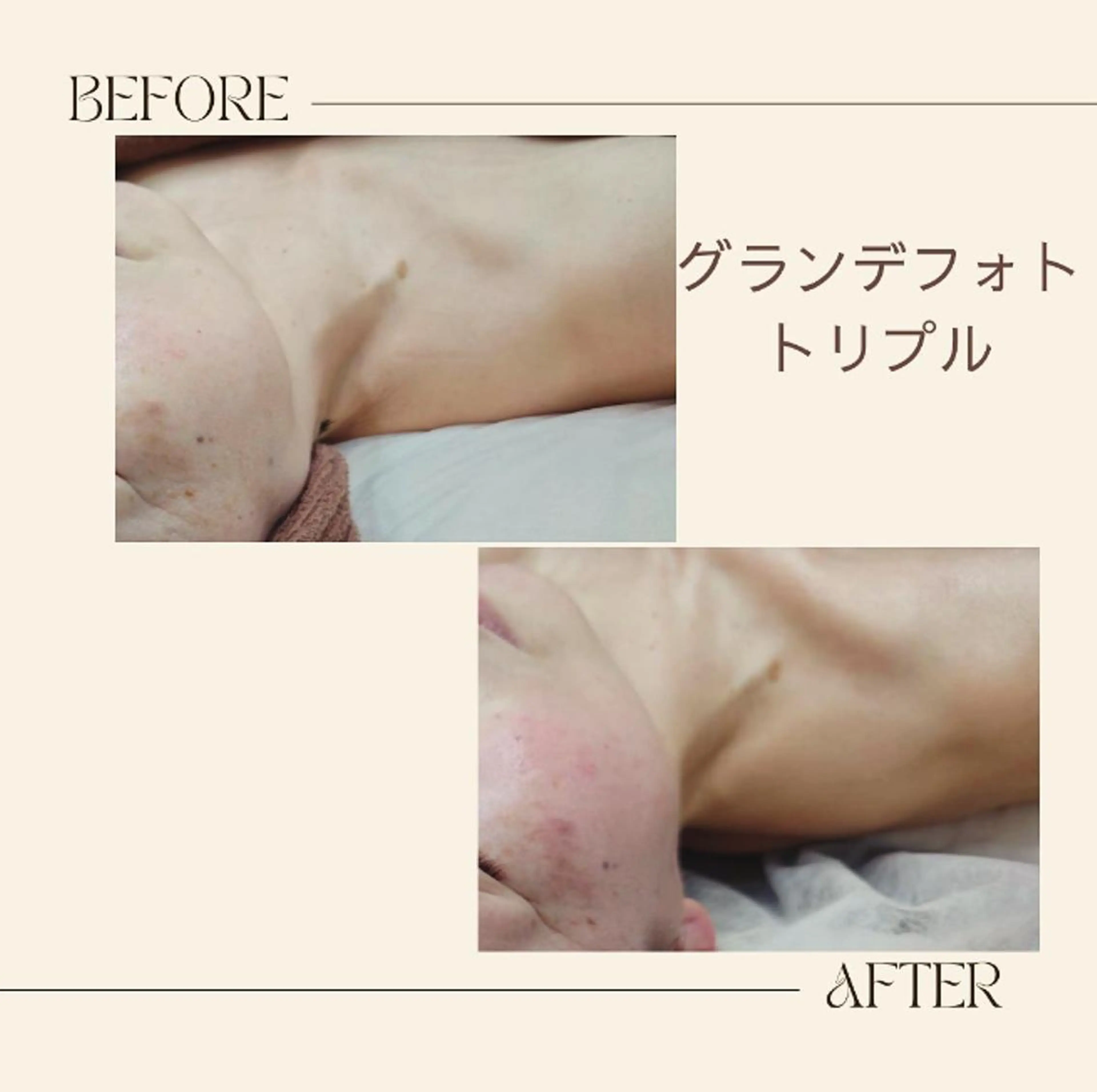 ラブニール 恵比寿店のエステ・リラクイメージ