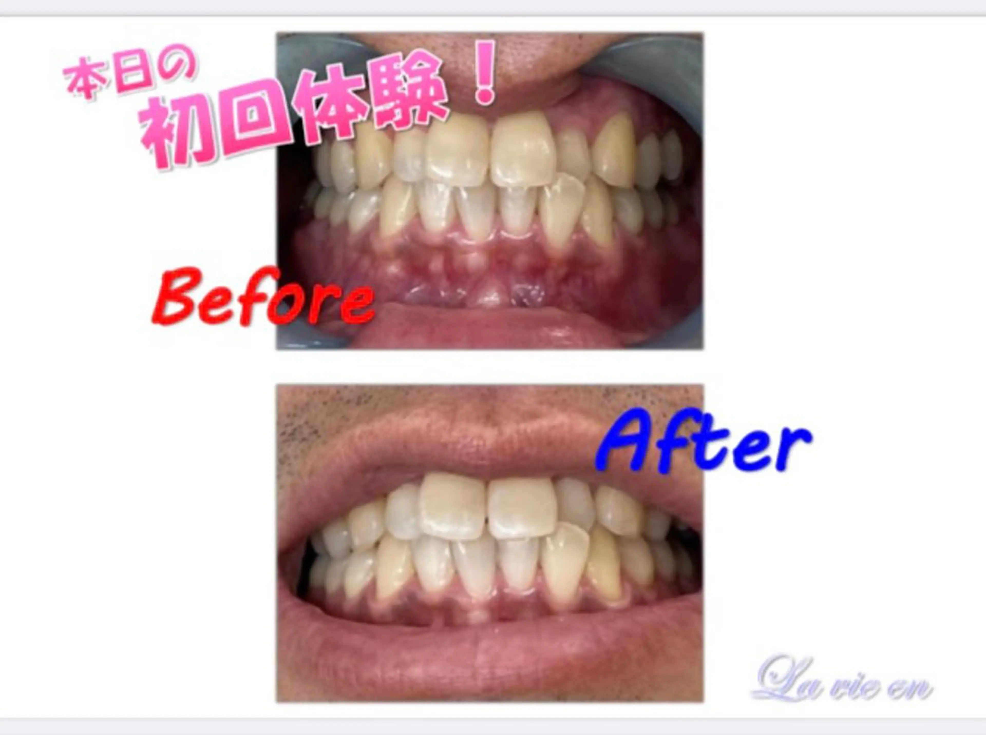 その他 セルフホワイトニングサロン　ラヴィアン所属・ホワイトニングサロン La vie enのその他イメージ