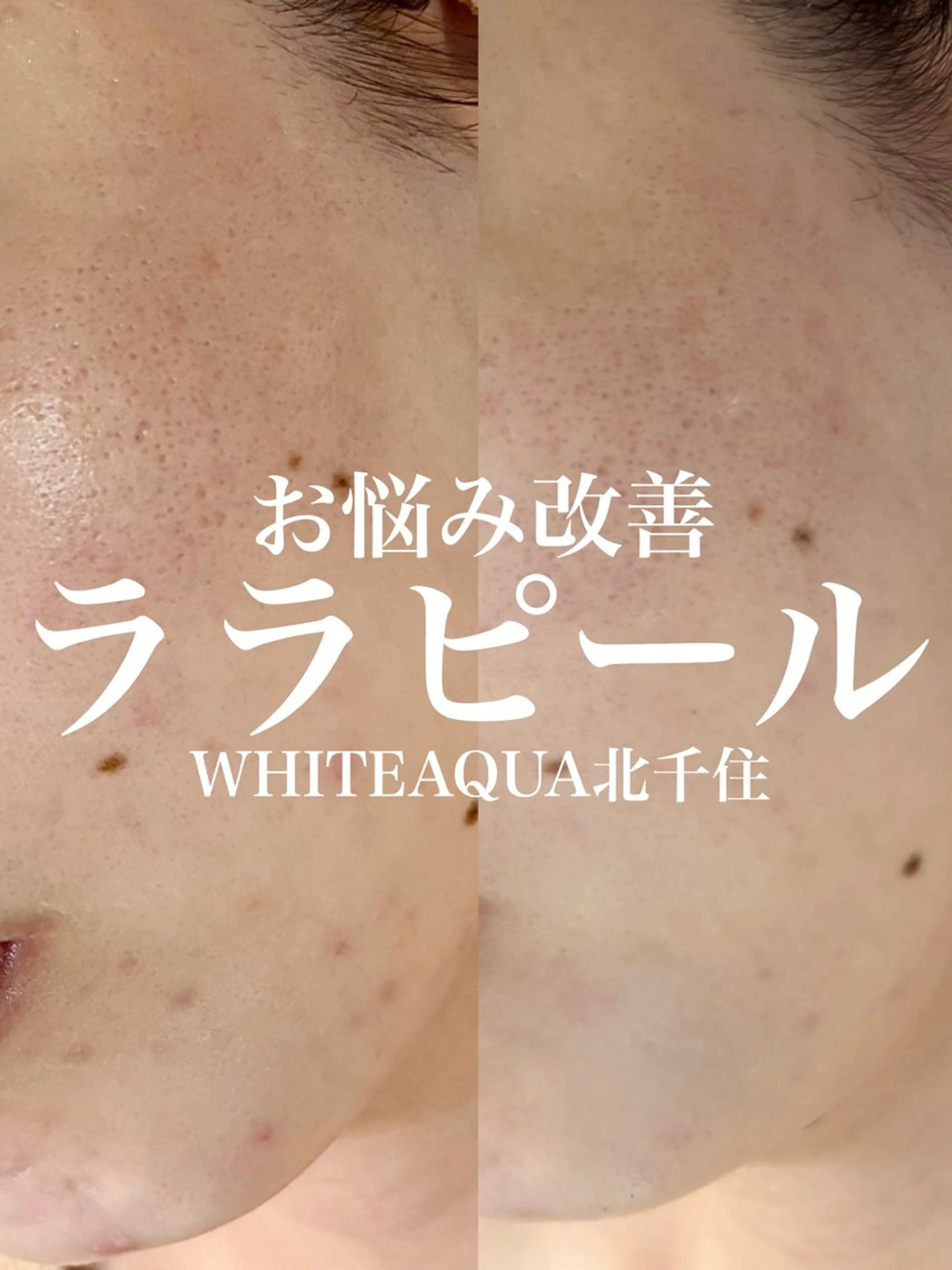 WHITE AQUA 北千住店のエステ・リラクイメージ