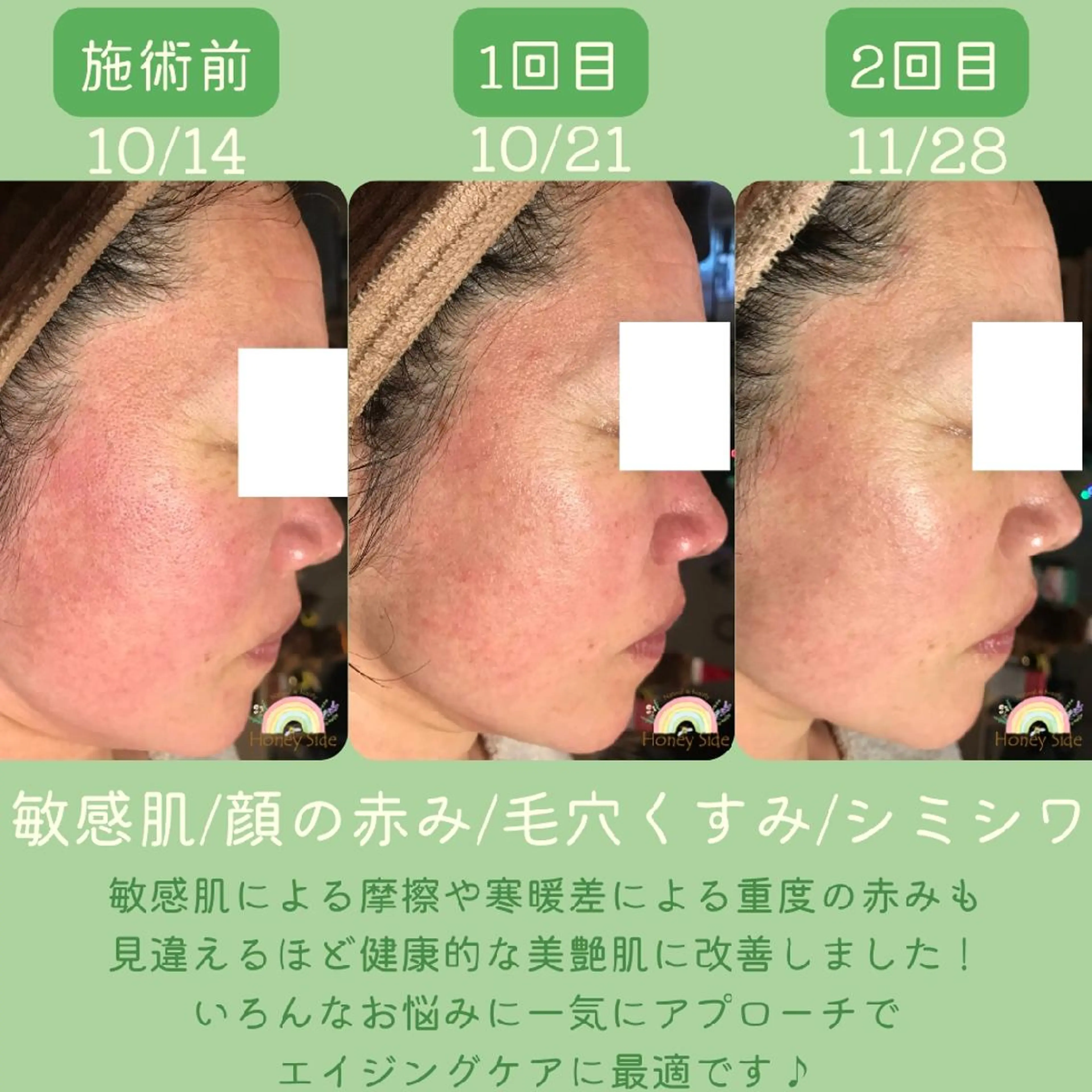 エステ 剥離するハーブ🌈 Honey Sideのエステ・リラクイメージ