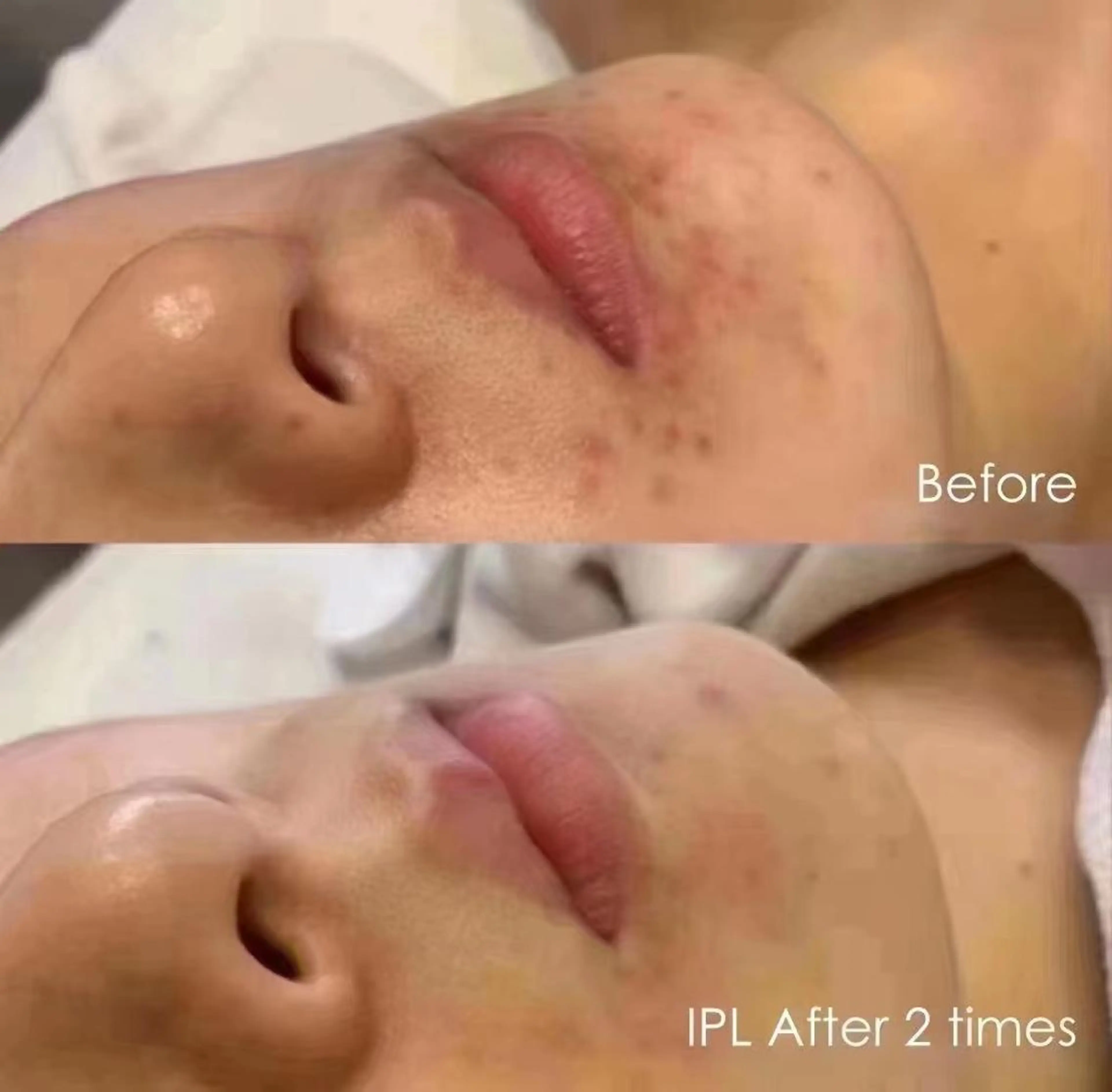 Einami 美肌痩身サロンのエステ・リラクイメージ