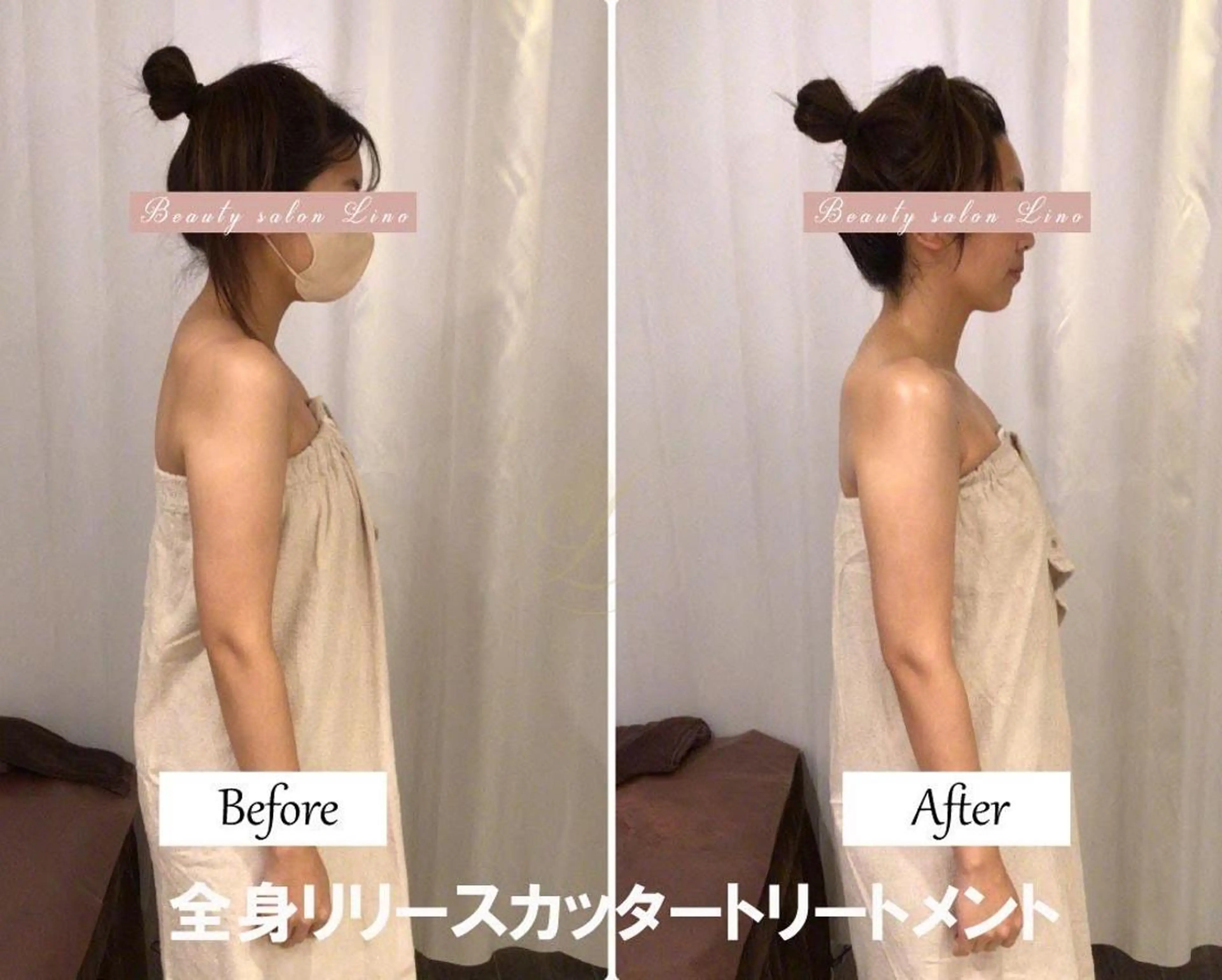 エステ リラク 肩こり改善 筋膜リリースカッターのエステ・リラクイメージ