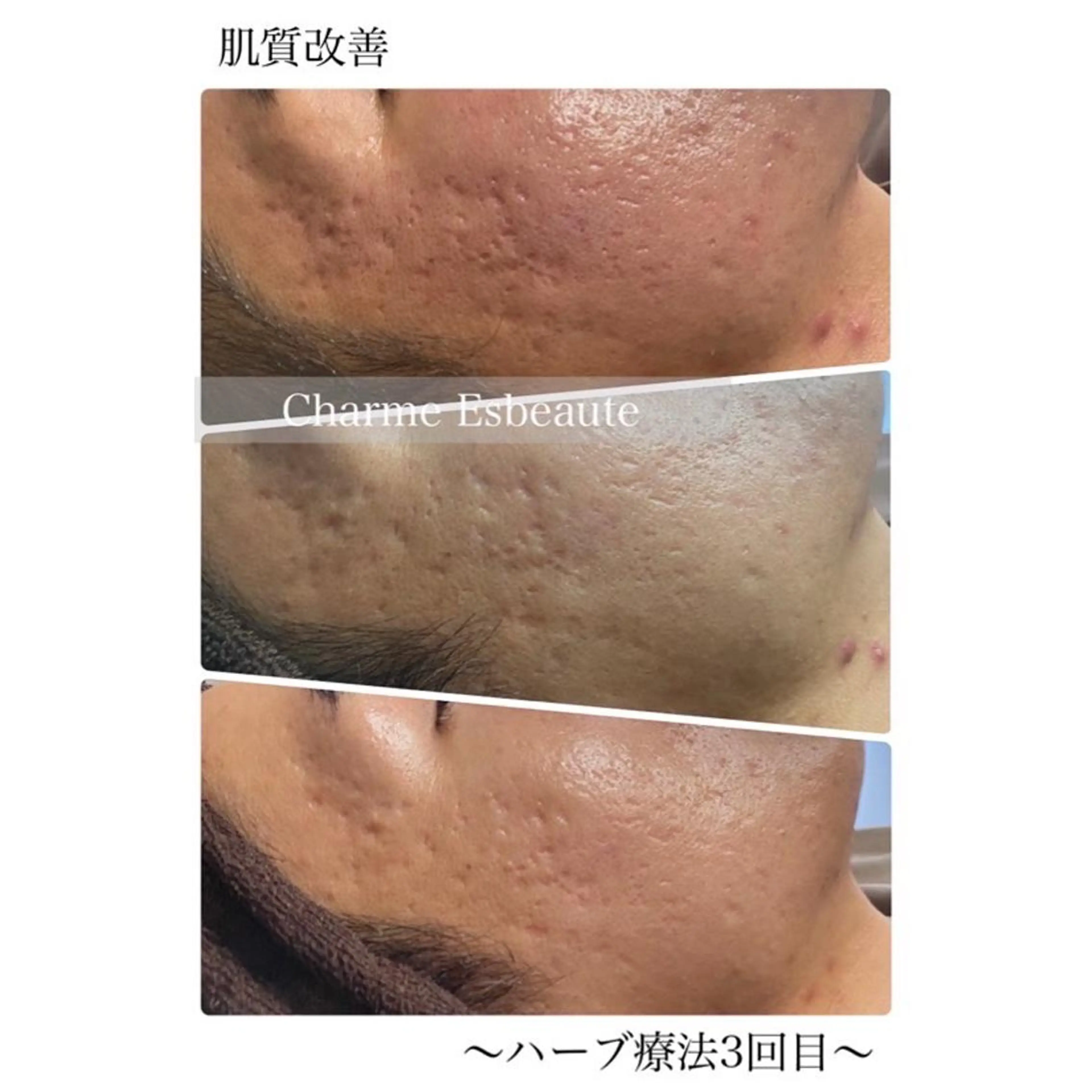 Charme Esbeaute所属・Charme Esbeauteのマツエク・マツパデザイン