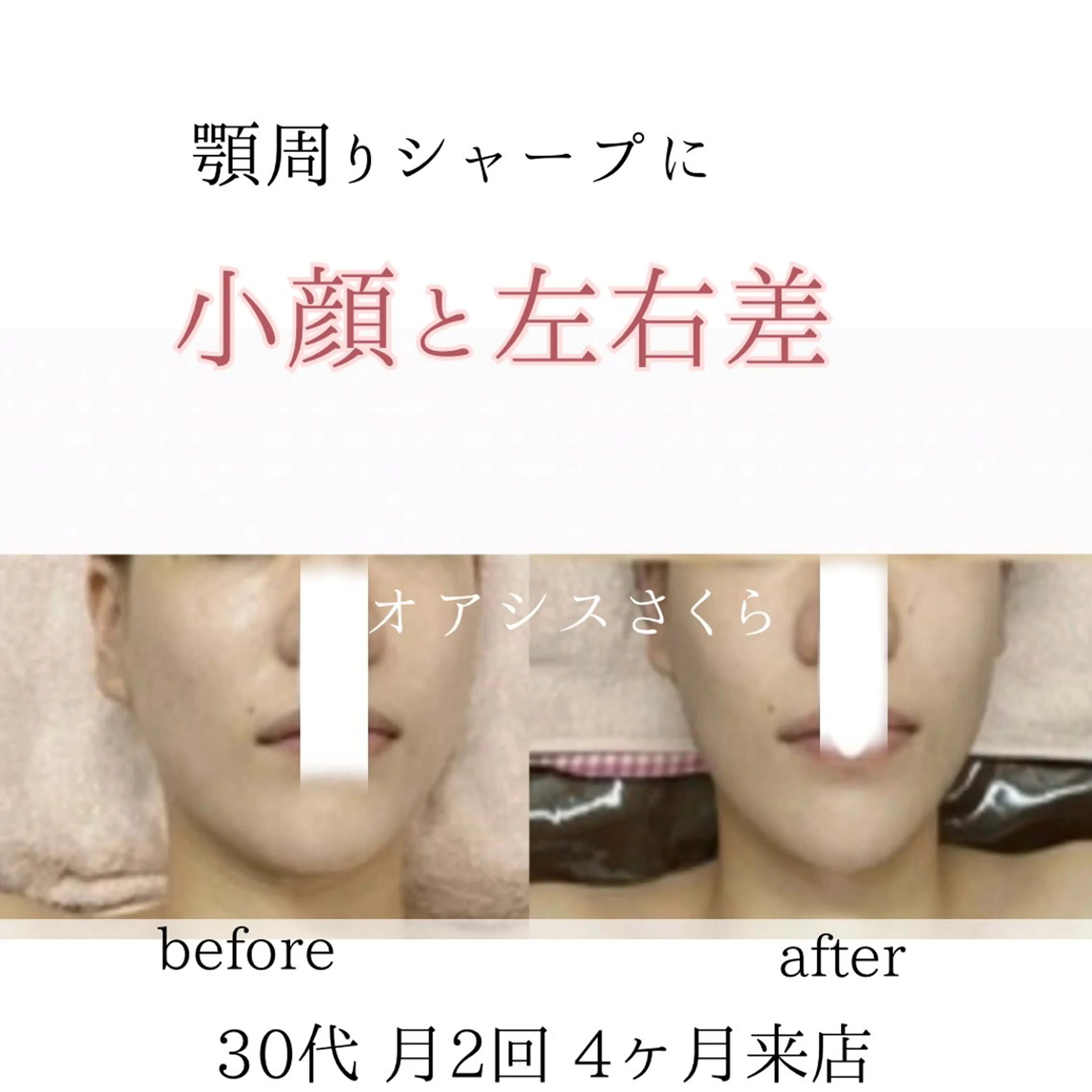 オアシス・さくら所属・自然美人を叶える小顔 と脱毛サロンのエステ・リラクイメージ